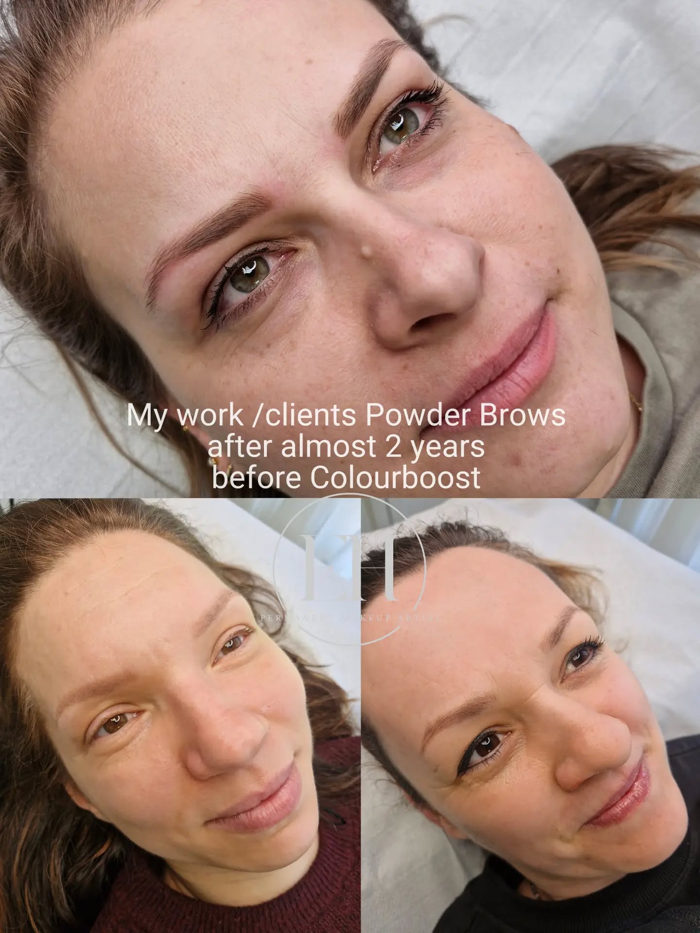 Lots of clients come to me with permanent makeup that, after a year or so, no longer looks natural…
Brows turning grey or ashy, pigment sitting too heavy in the skin, and not fading the way it should.
✨ This is NOT how permanent makeup should age.
When done correctly, your brows should fade softly and evenly — staying true to colour, just becoming a lighter version of the original.
That’s exactly what I focus on.
I’m proud to show my loyal clients who’ve been coming to me for years — their brows fade beautifully, with no greys or blues, just soft, natural brown tones that gently lift from the skin over time.
👉 These photos are almost 2 years after their last colour boost.
This is what you want from permanent makeup:
✔️ Natural results
✔️ True-to-tone fading
✔️ Skin that’s ready for a fresh colour boost when needed
No harsh blocks. No unwanted colour changes. Just timeless, natural-looking brows — always.
If you want brows that age beautifully, you know where to come 🤍
#ehpermanentmakeup #permanentmakeupstalbans #NaturalPermanentMakeup #powderbrows