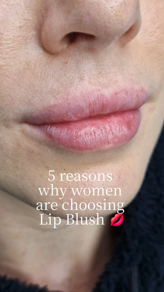 Perfect for women who want to feel confident without heavy makeup.
#ehpermanentmakeup #lipblushstalbans #lips #NaturalPermanentMakeup