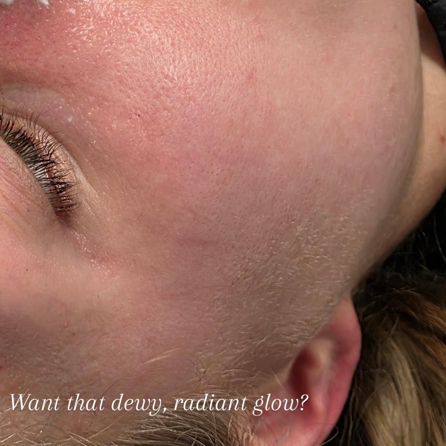 Ready to level up your skincare game? 🤔 Advanced facials are like the VIP treatment for your skin, going way beyond your basic cleanse. They involve specialized techniques and ingredients to tackle specific concerns you might have. Pair that with an in-depth skin consultation, and you're getting personalized advice tailored just for YOU! 💡 This is where we really dive into your skin's unique needs and create a custom plan. Think of it as a roadmap to your healthiest, glowing skin ever. ✨ So excited to help you on this journey! All you need to do is book online for a Skin Consultation ✨️
#AdvancedFacials #SkinConsultation #SkincareRoutine #HealthySkin #GlowUp SelfCareGoals