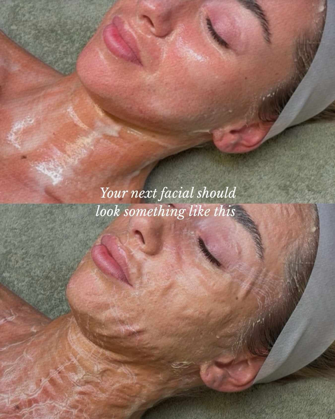 “Your next facial should look like this 💫”
That signature enzyme tightness you can feel working—stimulating, lifting, and encouraging pulsing blood flow to bring fresh oxygen and nutrients to the skin.
It’s not just a facial, it’s your skin being reminded how to function at its best ✨