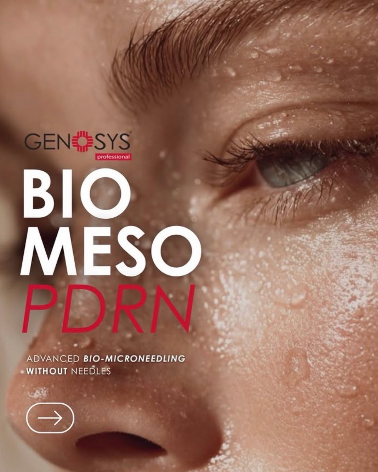 💁♀️Just Some information for one of the most popular treatments that got our client rebook often lately #biomesopdrnmicroneedling from @genosysnz ❤️❤️!
We are proud to be one of the first clinics in Wellington introducing this amazing product and treatment when it first came out last year!!!
If you haven’t tried this Biomeso PDRN treatment, hit the link and book now 👇
Www.fabulashbrows.co.nz
.
.
.
#skinrejuvination #wellingtonskinclinic #mesotherapyfacial #skintightening
