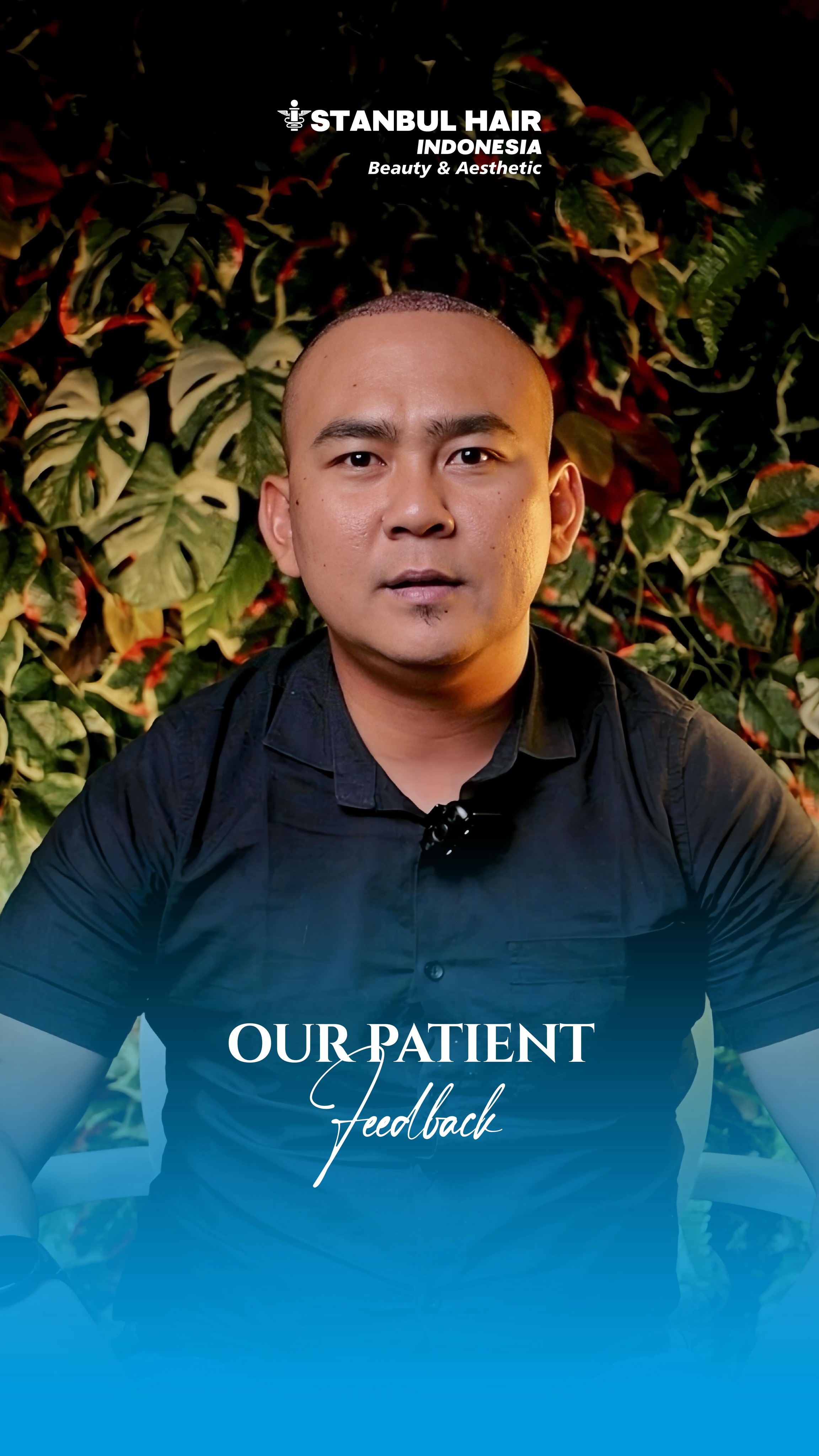 Dari Medan 🇮🇩 datang ke Jakarta untuk satu tujuan: perubahan nyata.
Dengan 5.300 grafts, setiap detail dirancang untuk menciptakan hasil yang natural, presisi, dan meningkatkan rasa percaya diri.
Di Istanbul Hair Indonesia, ini bukan sekadar tindakan—ini adalah perjalanan menuju versi terbaik diri Anda.
—
From Medan 🇮🇩 to Jakarta with one goal: real transformation.
With 5,300 grafts, every detail is carefully designed to deliver natural, precise results and boost confidence.
At Istanbul Hair Indonesia, it’s not just a procedure—it’s a journey to your best self.
#HairTransplantIndonesia #HairRestorationJourney #FUEIndonesia #NaturalHairline #Confident
