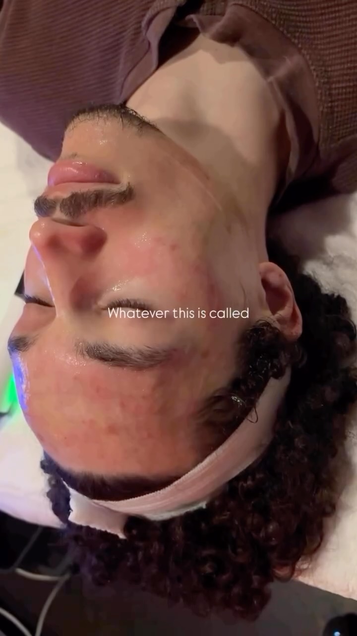 Self-care, therapy, necessary… all of the above? 🤩🫧
Glo2Facial uses “oxfoliation” to create CO2 bubbles on the skin, triggering oxygenation to penetrate nutrient rich serums deep into the skin, leaving the skin glowing 🌟
Facial by Micaiah
#renoskincare #renoesthetician