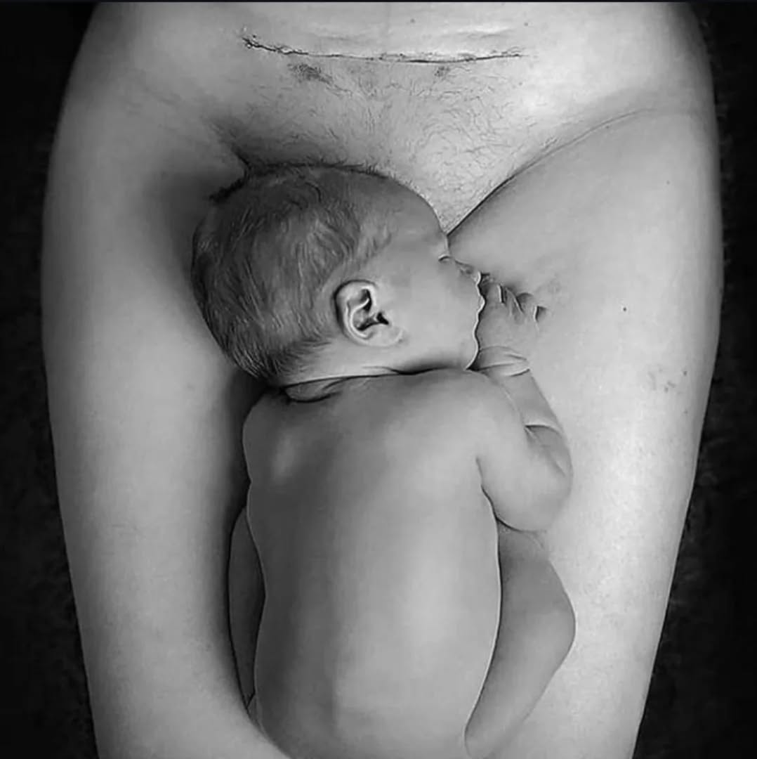 April is Caesarean Awareness month π It's important to consider your recovery after a Caesarean birth, whether that's planned or not, it can be tough going trying to take care of yourself whilst looking after a newborn! Here's some ideas:
π Obviously rest as much as possible. You've had major abdominal surgery, if this was any other similar scenario then you'd prioritise resting, right?! Now is the time to call in all those offers of help - you will recover quicker if you don't push yourself to be doing everything as soon as possible. Equally, set boundaries when it comes to visitors - your recovery matters more than them getting their 'baby fix'
π Prioritising you by ensuring your dressing is changed frequently (basic stuff I know, but your mind is on your newborn most of the time!) Do allow the air to get to the wound when switching dressings, and wear loose clothing
π Do try to get things moving, maybe try prune juice if everything is a bit on the slow side
π Peppermint tea is useful for trapped wind, this is common after a Caesarean
π Arnica can be taken in tablet form (check this is OK for you) to reduce swelling and inflammation and can be applied topically once your scar has healed. Likewise, teatree and lavender oil may be useful in aiding healing.
π Don't stop taking pain relief too soon!
There is no rush to get back to normality just yet. Don't succumb to the pressure of feeling like you should be up and about and getting on with everything. Just focus on your family and recovering for the time being π
What would you add to this list? Any useful tips?
.
.
.
#caesareanawarenessmonth #caesareanbirth #heavenlyhypnobirthing #positivecaesarean #hypnobirthingcourse