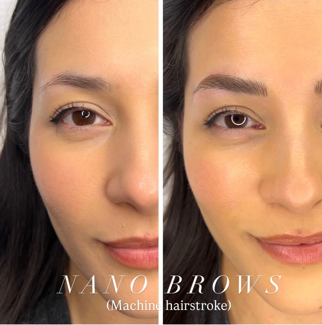 Nano Brows - Hyperrealistic Brows
(Machine Hairstroke)
Want REAL hair-like strokes? Nano brows create ultra-fine lines that actually heal like natural brow hair ✨
🔖 PriceList - saved in highlight
Book your appointment now! 💕
📲 Link in bio
📩 DM or WhatsApp: +44 7399288821
#phibrowslondon #ealingmicroblading #nanobrows #hyperrealisticbrows #laserremoval