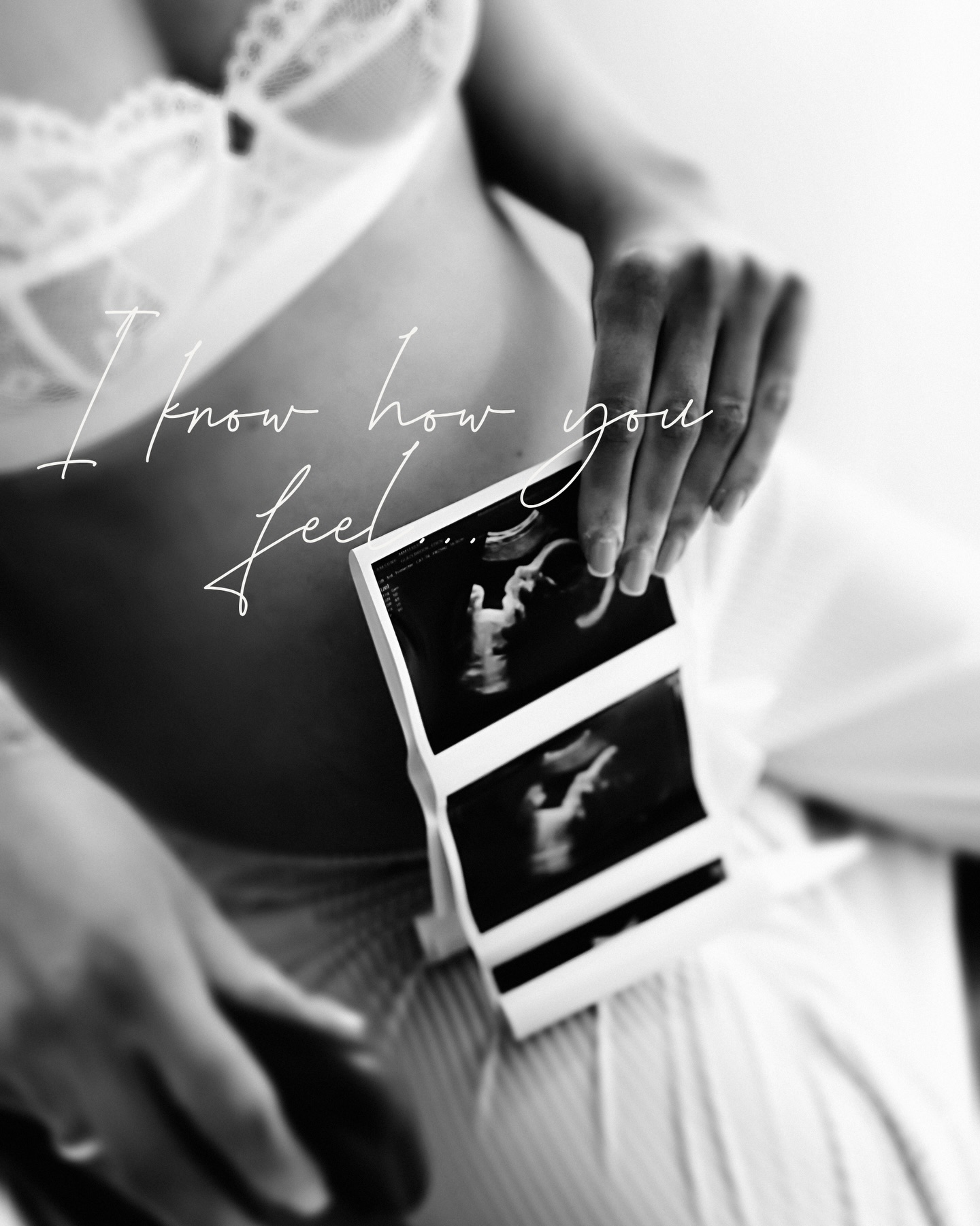 Can I say something to the mum to be who is running on empty right now?
You do not need to feel your best to look your best. You do not need to have your hair perfectly done, your life perfectly organised or your energy levels anywhere near normal. You just need to get ready show up, and I will take care of absolutely everything else.
I know pregnancy can feel relentless sometimes. The tiredness, the aches, the days where you just do not feel like yourself at all. But here is what I also know, when you are sitting in my studio and we start capturing this season of your life, something shifts. My clients always tell me how much they needed that time, just for them.
You deserve that too.
Your outfits are ready and waiting, there is nothing to organise, nothing to stress about. Just you, your bump and a couple of hours that are entirely yours.
Where emotion becomes art and moments become timeless.
If you’re intrigued but pretending you’re not.... message me 😉
www.babyphotographykent.uk
Links in bio!
#maternityphotographerkent
#kentmaternityphotographer
#bumpphotography
#maternitysessionkent
#babyphotographykent