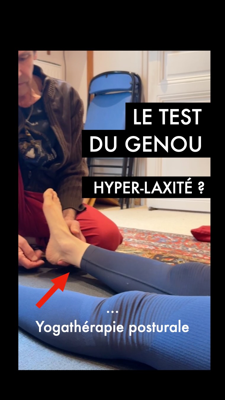 L’HYPERLAXITÉ N’EST PAS DE LA SOUPLESSE 🦴
LA YOGATHÉRAPIE POSTURALE LE DÉCRYPTE POUR VOUS !
Regardez attentivement cette vidéo extraite d’un bilan postural Yoga.
Ce que vous voyez — un talon qui se soulève du sol alors que le genou reste « collé » — n’est pas une preuve de souplesse.
C’est le signe d’un Recurvatum (hyper-extension). 👀📐
L’ERREUR BIOMÉCANIQUE CLASSIQUE :
Dans de nombreuses écoles et lignées de Yoga on enseigne de soulever le talon pour « bien tendre » la jambe et tonifier le genou.
C’est une erreur grave. 🚫🧠
En faisant cela, vous recrutez les mauvais muscles (ischio-jambiers et gastrocnémiens) qui verrouillent l’articulation en hyper-extension au lieu de la stabiliser.
LE DANGER POUR VOTRE STRUCTURE :
Perte de congruence
Usure silencieuse du genou
Répercussions globales : �Le bassin bascule en hyper-antéversion, projection de la cage thoracique, le diaphragme ne peut plus faire son travail et le souffle se bloque. �La respiration est haute. 🫁
NOTRE ALERTE : ARRÊTEZ D’AGGRAVER LE RECURVATUM ! 🔔 �Nous tirons la sonnette d’alarme : soulever le talon et ramener les orteils vers soi détruit votre capital genoux. Continue à inverser l’arche antérieure du pied en mettant en tension les releveurs des orteils.
LA SOLUTION : L’ÉVERSION DU PIED. ✨👣 C’est le seul mouvement physiologique du pied et il permet de restaurer la neutralité articulaire et de recruter les bons muscles c’est à dire les quadriceps qui doivent tendre les genoux et ainsi maintenir la rotule haute et manchonnée sans effort. 🏛️⚓
💬 Et vous, on vous a déjà demandé de soulever le talon en cours ? Faites le test et dites-le nous en commentaire ! 👇�
#YogaTherapie #Genou #Anatomieappliquée #biotensegrite #CathEtSergeYoga