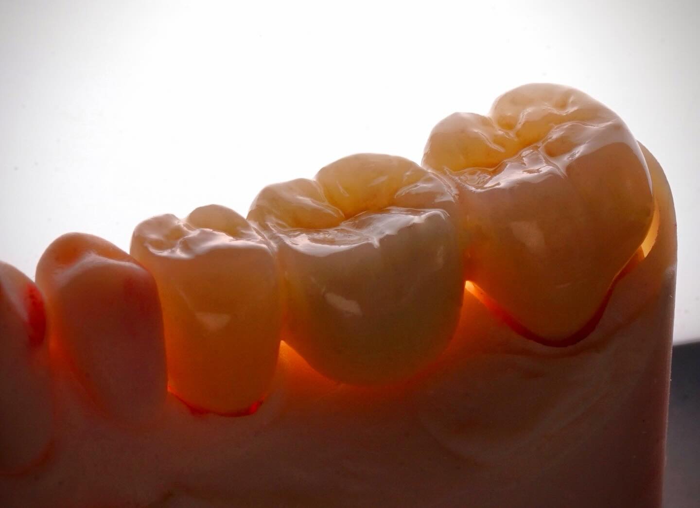 Close up 📸 #crownifydental