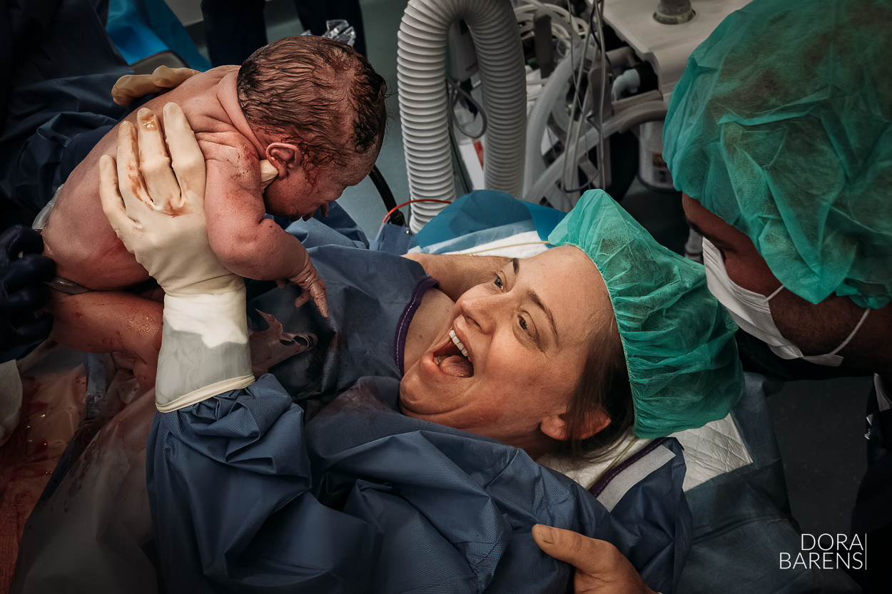 She chose not to find out. Not once during those nine months.
After a previous traumatic emergency c-section, she chose this birth differently. A moment she could be part of. A moment she could reclaim. A Mother Assisted C-section (MAC).
And then… she lifted her baby up herself.
“You’re a girl.”
You can see it land. The surprise. The relief. The healing, all at once.