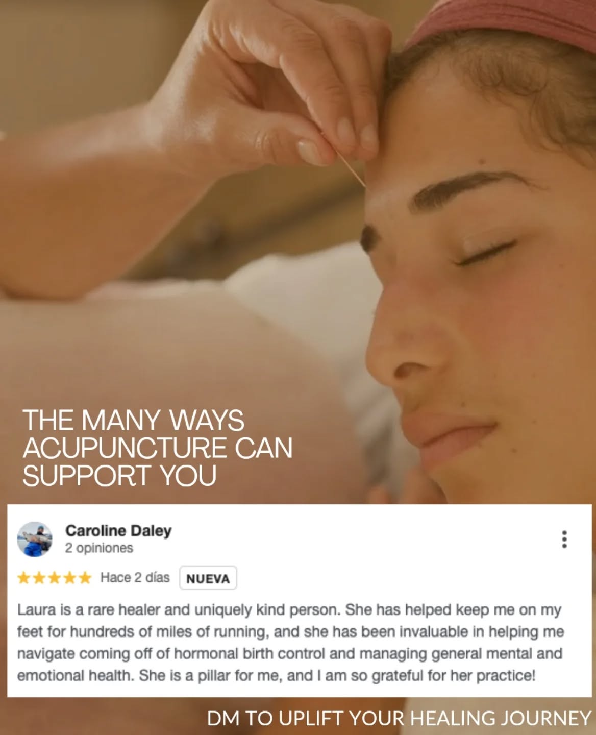 This is why we do this work.
Witnessing how this kind of care supports real, meaningful shifts in someone’s life is deeply fulfilling.
When shifts are multidimensional, health unfolds and potential expands.
From navigating hormonal changes to feeling more grounded in your body and mind to running hundreds of miles.
This care meets you where you are, evolving with you over time.
That continuity is what makes the difference.
We’re here to support you, wherever you are on your healing journey 🤍
Book today, potential awaits!
#HolisticHealing
#AcupunctureHealing
#MindBodyWellness
#WomensHealthJourney
#SantaCruzCalifornia