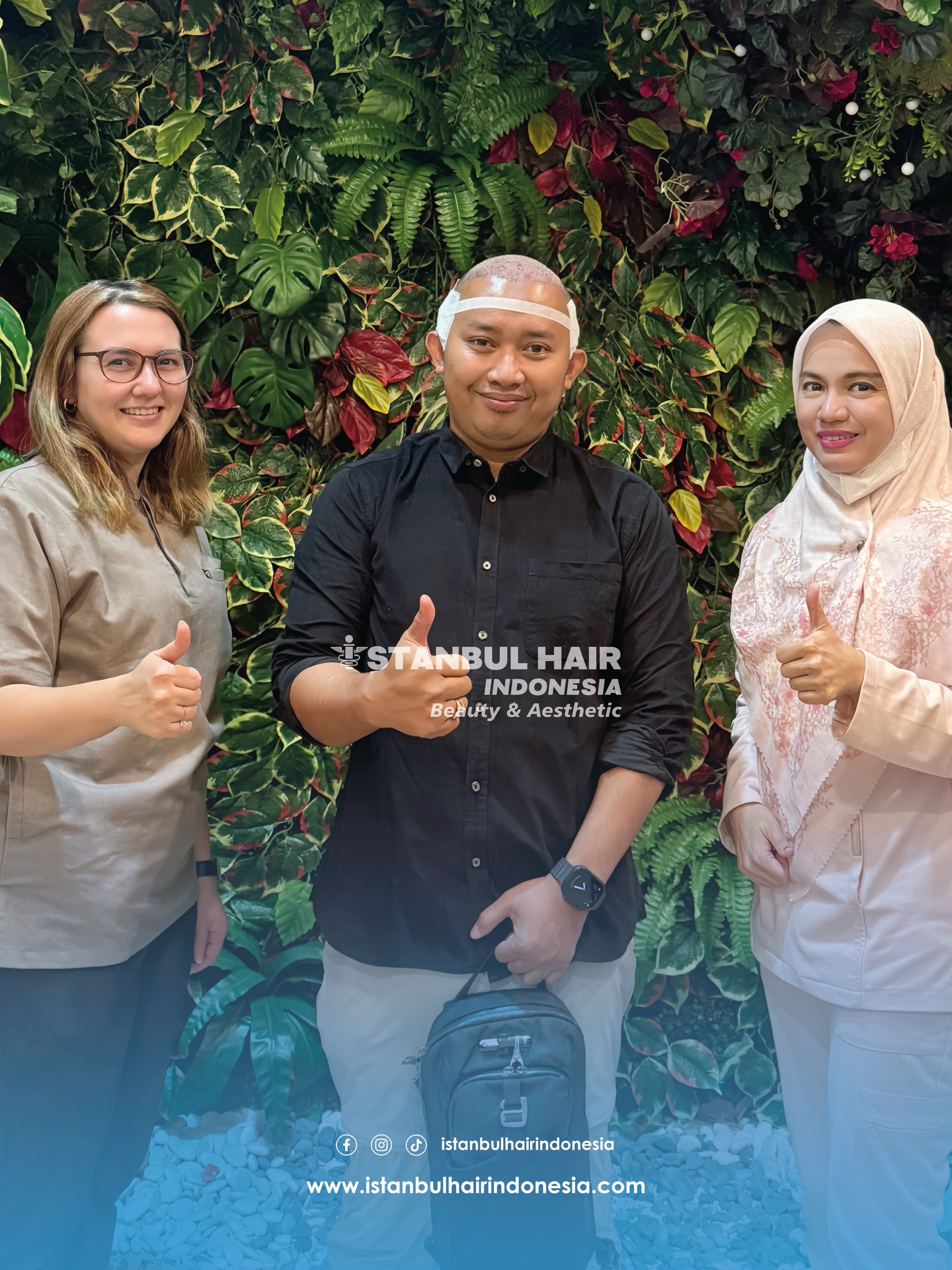 Awal dari perubahan nyata ✨
Dengan 3.900 grafts — saat ini masih berada di fase awal pasca tindakan. Proses ini bukan instan, tapi setiap tahap membawa hasil yang semakin terlihat. Nikmati prosesnya, percaya hasilnya.
———
The beginning of real transformation ✨
With 3,900 grafts — currently in the early post-procedure phase. This journey isn’t instant, but every stage brings you closer to visible results. Trust the process, trust the outcome.
#HairTransformationID #HTJourney #IstanbulHairIndonesia #GrowthTakesTime #NewHairNewConfidence