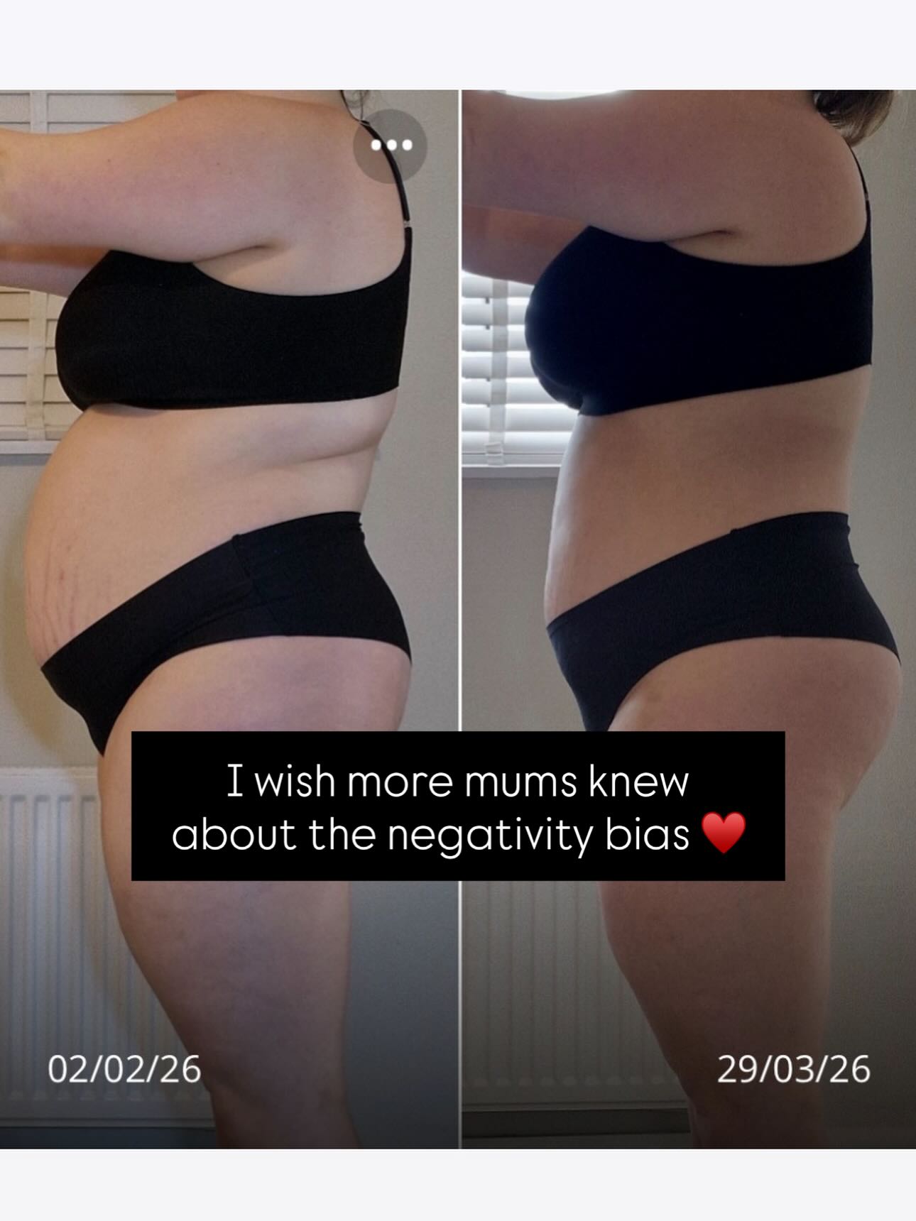 You’re not failing.
Laura didn’t fail. She absolutely smashed the Core Builder program and WOW 🤯
I am so glad she reached out to me - feeling demotivated and unable to see a change!!!
Sometimes you just need a different set of eyes to show you what you’re not seeing.
Laura, I am genuinely beyond proud of you for completing
Your brain filters what you see.
It’s called negativity bias 👇
and it’s the reason so many mums quit right before things start working 😢
Because instead of seeing:
✔️ REAL changes in body shape
✔️ getting stronger
✔️ building a habit of exercise
✔️ More energy, less aches
✔️ A new improved posture
✔️ Your deep core healing
✔️ A mum getting that ‘spark’ back
You see:
❌ A photo which is hugely misleading
❌ “my tummy still looks the same”
❌ “I don’t look different”
❌ “this isn’t working”
❌ Unreliable numbers on scales
So you stop.
But it’s not what I see 👀
And if you quit now?
You’ve taken away your chance of moving forward, all because your brain is on self sabotage mode 😭
So if you’re in that “nothing’s changing” phase right now…
Please don’t disappear.
Reach out to me.
Let me show you what you’re missing & give you that nudge you need for the new month 🥰💬
WELL DONE on ANY effort you made this MARCH, it counts 🙌
#katesmumfitclub #corestrengthening #workoutsformums #mummymotivation #motherhoodjourney