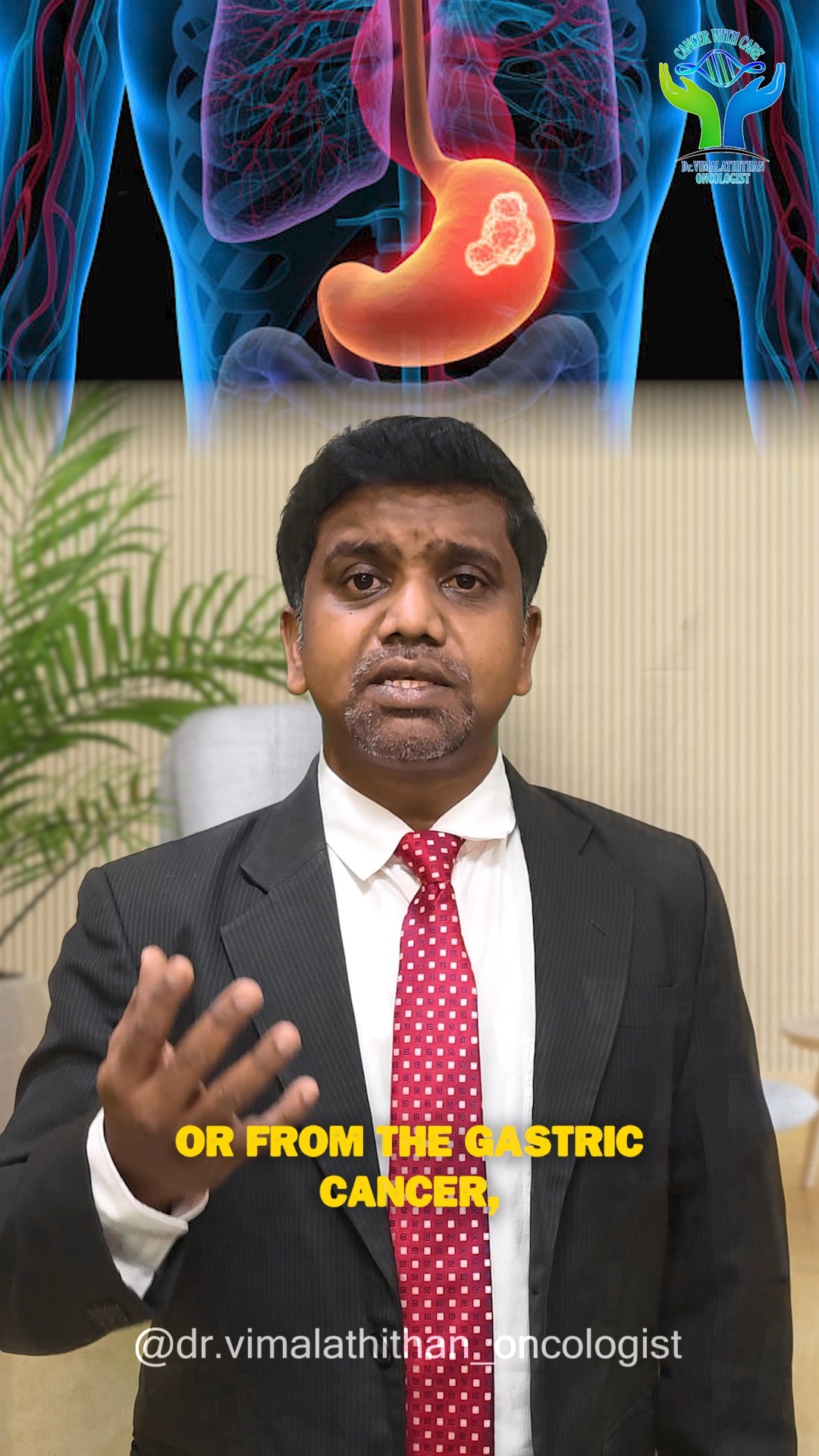 What is meant by PIPAC TREATMENT?
A latest novel revolutionary Cancer Treatment
PIPAC Treatment is changing the way we fight advanced abdominal cancers — delivering chemotherapy directly where it’s needed most, with precision and care. A breakthrough approach bringing new hope to patients 💙
#PIPAC #CancerTreatment #CancerCare #Oncology #MedicalInnovation #HealthcareRevolution #HopeInHealing #AdvancedTreatment #MinimallyInvasive #CancerAwareness #ModernMedicine #HealingJourney #HealthCareIndia #ChennaiDoctors #FightCancer