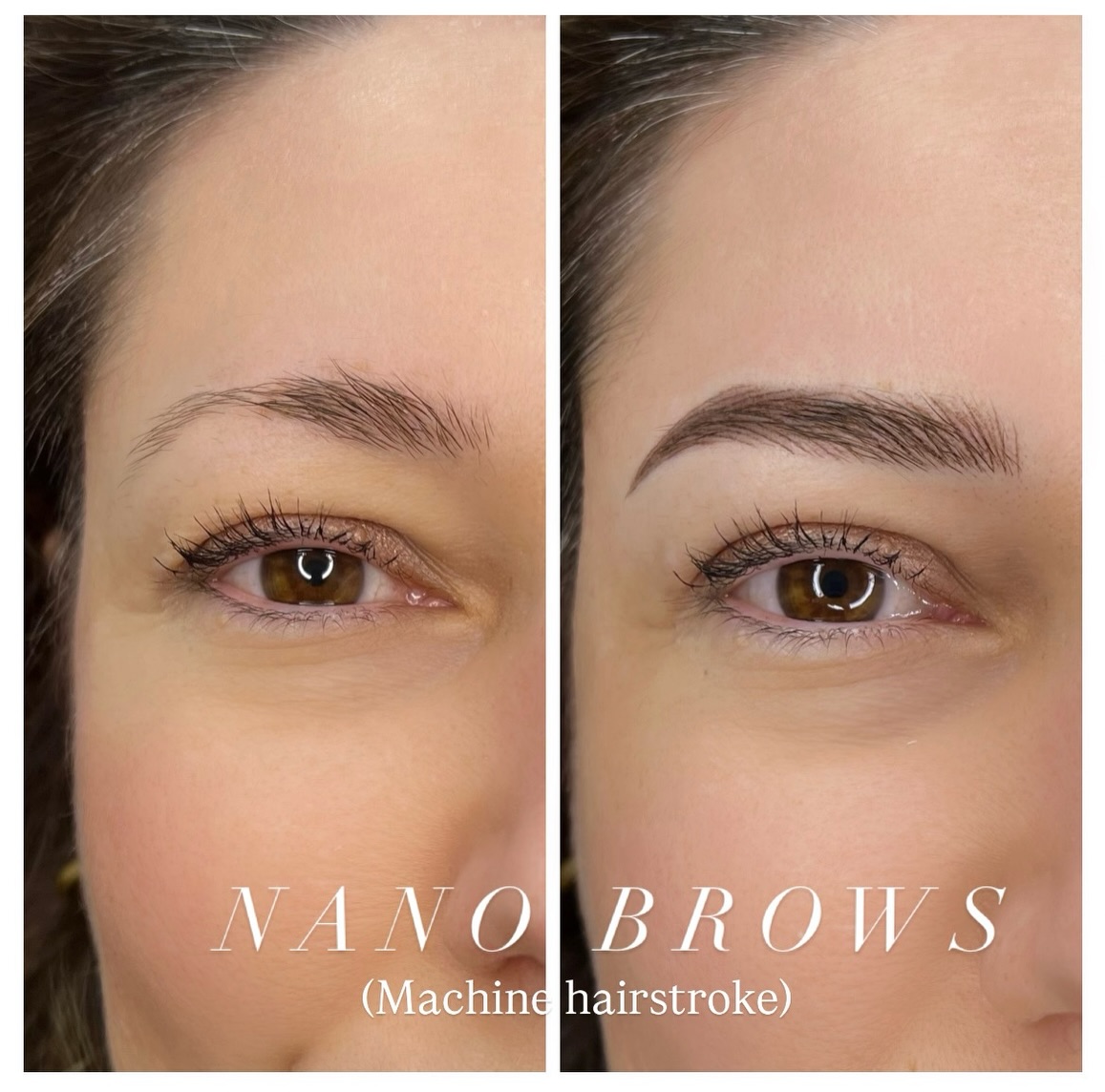 Nano Brows - Hyperrealistic Brows
(Machine Hairstroke)
Want REAL hair-like strokes? Nano brows create ultra-fine lines that actually heal like natural brow hair ✨
🔖 PriceList - saved in highlight
Book your appointment now! 💕
📲 Link in bio
📩 DM or WhatsApp: +44 7399288821
#phibrowslondon #ealingmicroblading #nanobrows #hyperrealisticbrows #laserremoval
