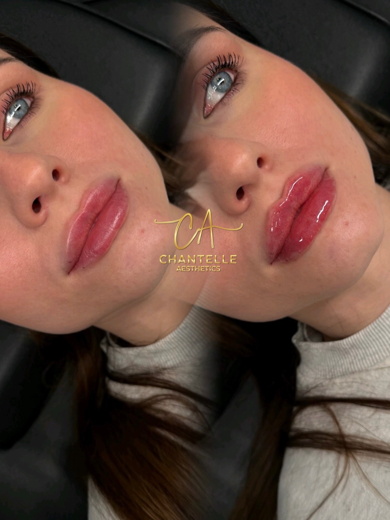 And just like that we’re back 🙂↕️
I won’t lie, I’ve been a little over social media lately.
The constant posting, dancing around, the pressure to show your whole life or get left behind… it’s a lot.
But today, after a little pep talk with a client (you know who you are 🤍), it reminded me why I started sharing in the first place.
The work. The results. The transformations I’m proud of.
Not the dancing around or giving so much to an algorithm that I lose myself and what my clinic stands for.
So here’s to getting back to what actually matters,
showing up, sharing my work, and most importantly having fun ✌🏻
So much has been happening behind the scenes over the last few months. We’re busier than ever and I have so many results to show you 🫶🏻