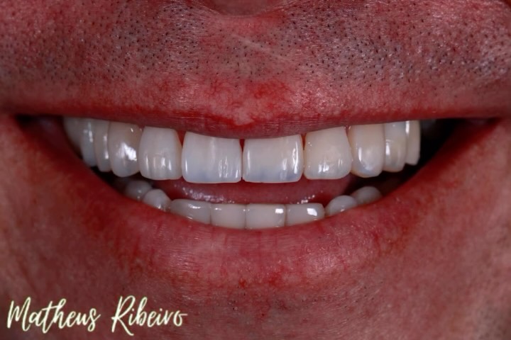 Essa transformação viajou para outro continente.
Levando esse sorriso até a Irlanda 🇧🇷✈️🇮🇪.