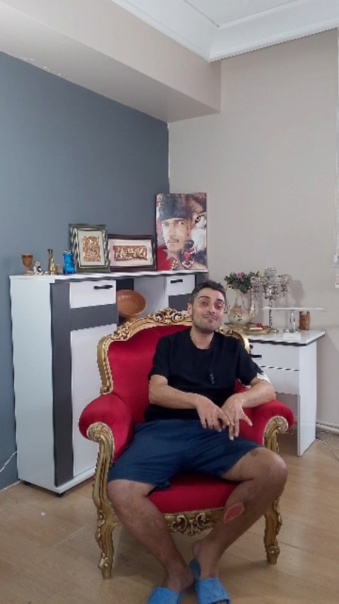 Eski Asker Afrin Gazisi Sait Kardeşimizin Tedavisini BAĞDER Olarak Üstlenmiş Bulunmaktayız 👍 (Part 1) @tcozturkkarahan #uyuşturucu #uyuşturucuyahayır #uyuşturucuylamillimücadele #keşfet #keşfetteyiz