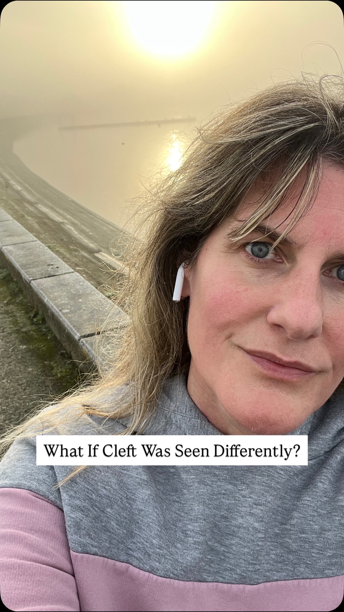 UK to Boston. If only it were that quick!! ✈️🌍😂
2007 me would NEVER EVER believe what we are doing over the next few days !!!
Art to change the narrative of cleft. 🙌
For Ella and all the incredibly exquisite wonderful humans from across the world who have ever felt unseen or unsafe in their bodies through their lived experience.
I see you ❤️
Thank you @americancleftpalate for your belief in these beautiful faces and their vital messages ❤️🙏🏻🥰
#cleft #cleftbeauty #cleftfamily