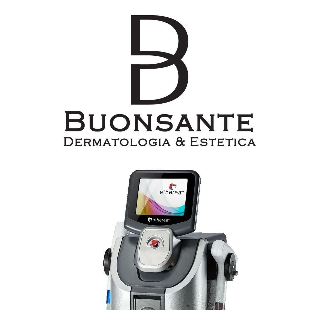 Te mostramos parte de nuestra tecnología para tratamientos de láser y luz pulsada ✨
Contamos con la plataforma Etherea, que combina distintas tecnologías para abordar múltiples indicaciones dermatológicas:
🔹 IPL (Luz Pulsada Intensa)
Mejora manchas, rosácea, enrojecimiento y calidad general de la piel. Ideal para unificar el tono y dar luminosidad.
🔹 Q-Switch Acroma
Indicado para lesiones pigmentadas, melasma y eliminación de pigmento. Actúa de forma selectiva sobre la melanina.
🔹 Long Pulse (Nd:YAG)
Tratamiento de vasos, telangiectasias y lesiones vasculares. También se utiliza en depilación y rejuvenecimiento profundo.
Cada tecnología se adapta a lo que tu piel necesita para lograr resultados naturales, progresivos y seguros.
📲 Consultorio: 1166662866
📍 Turnos con evaluación personalizada
#Dermatología #Laser #IPL #SkinQuality #Rejuvenecimiento Dermatóloga PielSana TratamientosFaciales BuenosAires