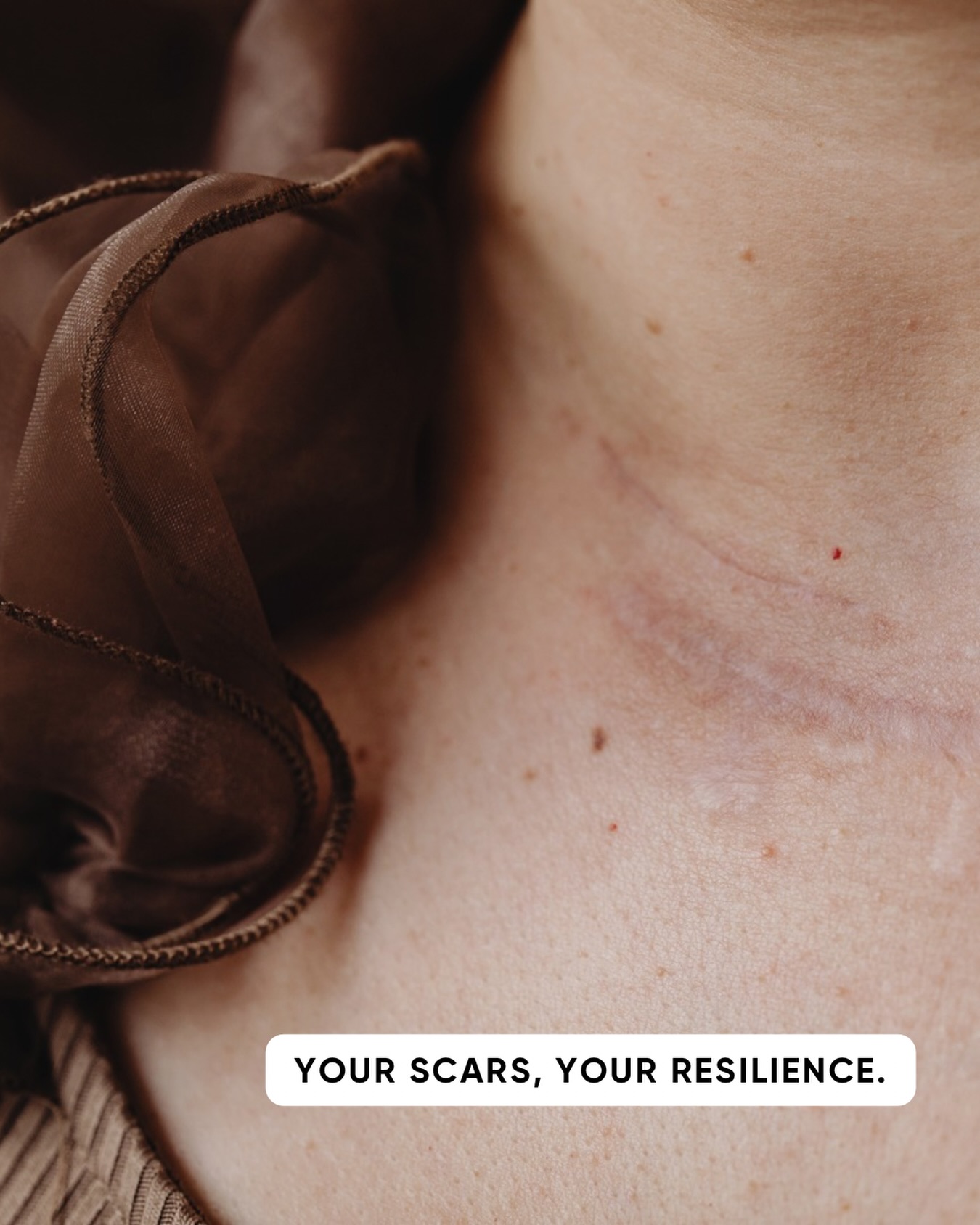 Scars tell a story - but they don’t have to hold tension, discomfort, or restriction forever.
Our massage therapists are trained in scar rehabilitation and can safely work with surgical scars including thyroidectomy, C-section, breast augmentation, and more to help improve mobility, reduce sensitivity, and support healing beneath the surface.
Gentle, intentional treatment can help restore movement, comfort, and confidence in your body. 🤍
✨ Scar care can begin once healing is complete and your healthcare provider has cleared treatment.
#scarrehab #scarmassage #csectionrecovery #postsurgicalcare #massagetherapy