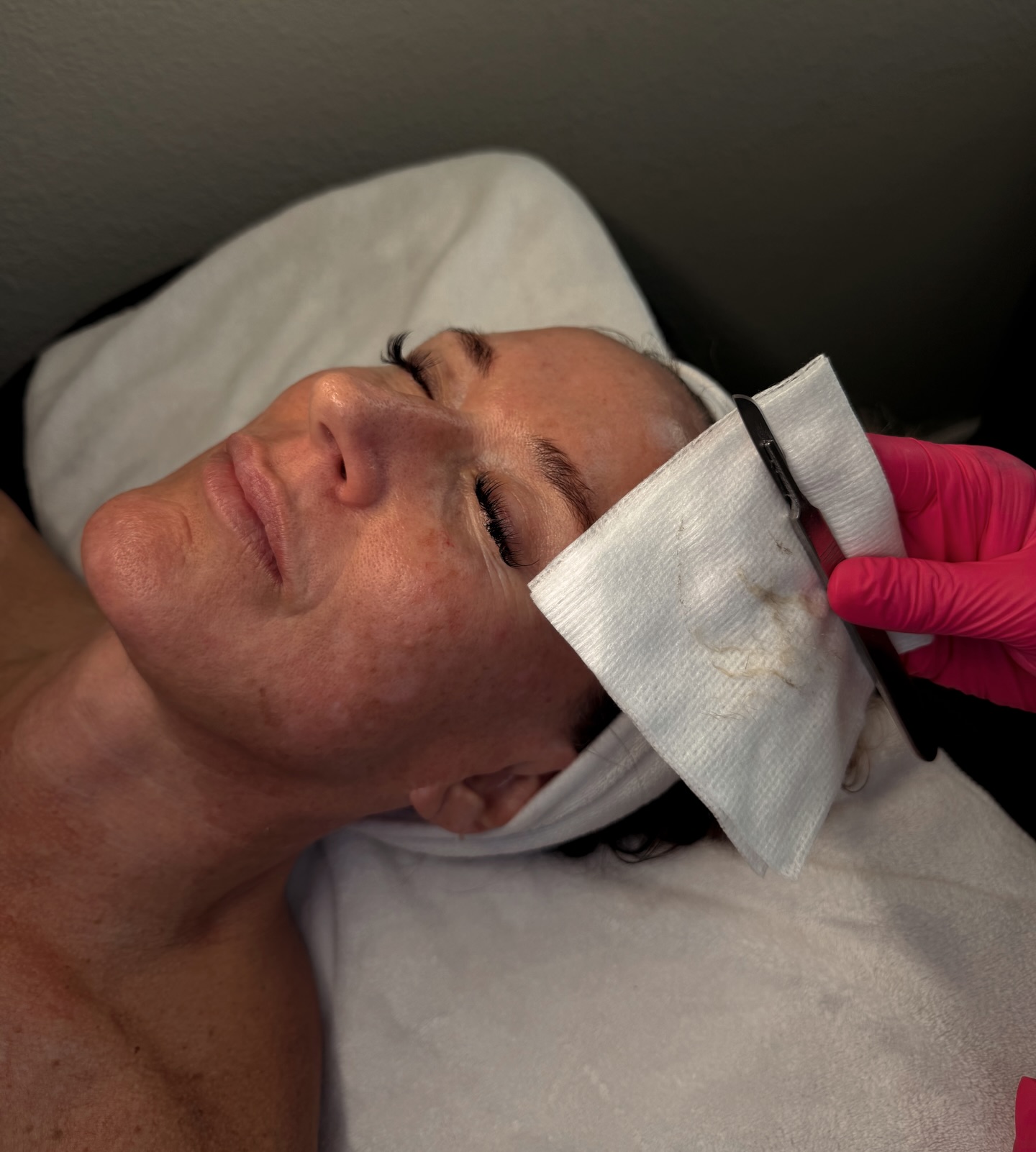 The smooth, glowing skin youâve been trying to achieve⌠starts here â¨
Dermaplaning gently removes dead skin and peach fuzz, instantly revealing a brighter, softer, more even complexion. Your skincare absorbs better, your makeup goes on flawlessly, and your skin just looks⌠refreshed.
No downtime. No waiting. Just immediate, noticeable results.
If your skin has been feeling dull or textured this is your sign đ¤
#GlamhouseAesthetics #SanAntonioMedspa #NewBraunfelsMedSpa #Dermaplane #Skincare