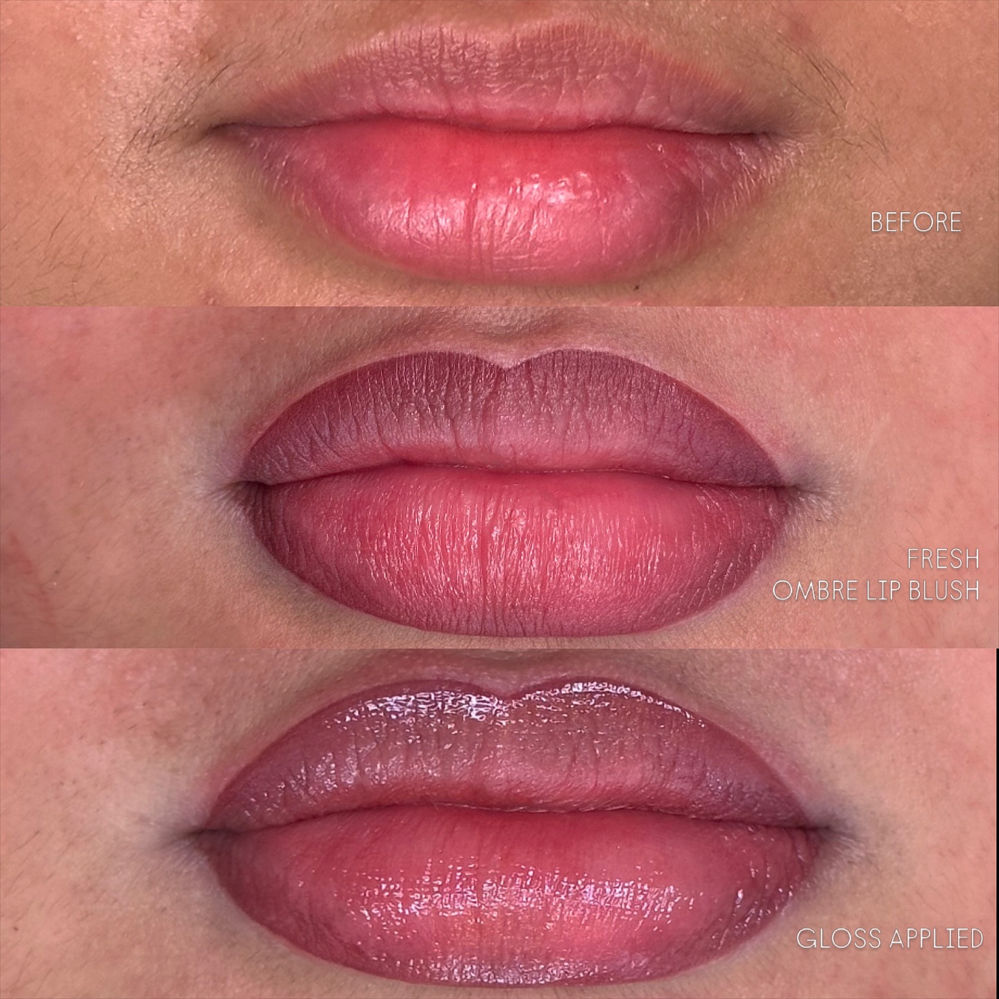 The powder of Ombre Lip Blush has me in a choke hold 😮💨
Swelling will subside over the following 2-6 hours x
#adelaidebrows #southaus #adelaidebeauty #eyebrow #eyebrows makeup beauty microblading brows eyelinertattoo eyebrowshaping permanentmakeup lashes cosmetictattooadelaide pmu brow cosmetictrainingadelaide PMUtraining adelaidepmumasterclass eyebrowtattoo micropigmentation browsonpoint northadelaide nanobrowsadelaide nanotattoo tattooremoval laser