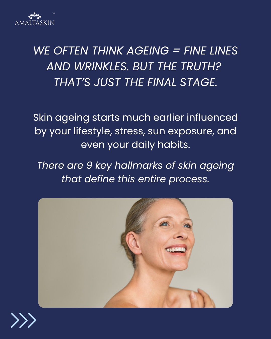 Let’s understand skin aging.
There are 9 key hallmarks of skin ageing that define this entire process:
✨ 1. Collagen breakdown
Your skin loses its firmness and structure over time.
✨ 2. Reduced cell turnover
Dead skin cells don’t shed as efficiently → dull, uneven skin.
✨ 3. Loss of hydration
Skin struggles to retain moisture → dryness, fine lines.
✨ 4. Pigmentation changes
Uneven tone, dark spots, sun damage become more visible.
✨ 5. Oxidative stress
Damage caused by pollution, UV, and lifestyle → accelerates ageing.
✨ 6. Inflammation
Chronic low-level inflammation weakens skin health over time.
✨ 7. Barrier dysfunction
Skin becomes more sensitive, reactive, and prone to damage.
✨ 8. Fat & volume loss
Leads to sagging, hollowing, and loss of youthful contours.
✨ 9. Slower repair & regeneration
Skin takes longer to heal and recover.
Once you understand these, skincare becomes a lot more intentional - not just about products, but about prevention and repair.
#ageing #skinageing #signsofageing #skin