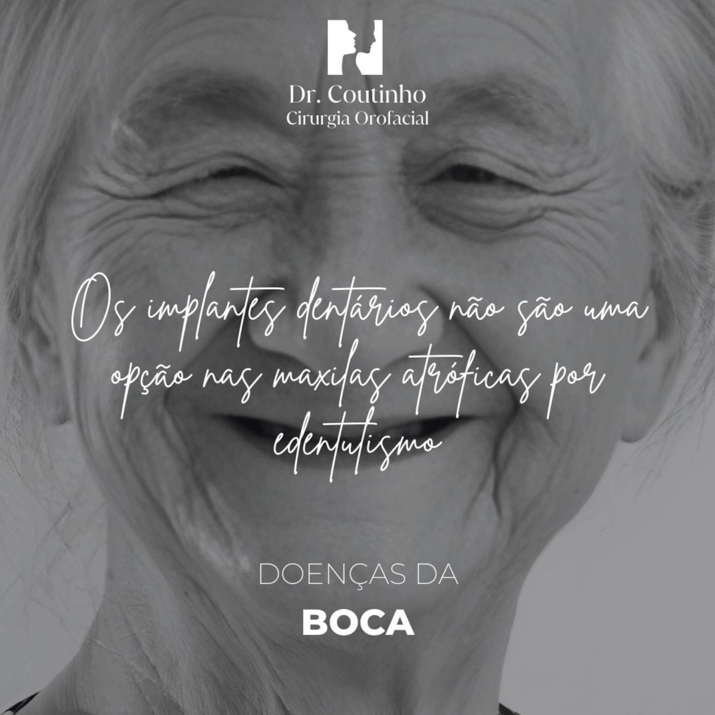 Transformamos desafios em sorrisos! 😁
Em casos de maxilas atróficas, dispomos de 3 soluções inovadoras: implantes angulados, implantes zigomáticos e implantes customizados.
Cada técnica é escolhida com base nas necessidades específicas do paciente, garantindo resultados estéticos e funcionais. 🦷✨
🌟 Para devolver a qualidade de vida aos pacientes, é importante saber:
🔹 Quando utilizar implantes angulados;
🔹 A eficiência dos implantes zigomáticos nos casos extremos;
🔹 Como os implantes customizados podem revolucionar a reabilitação oral.
💬 Deixe as suas dúvidas e vamos conversar. #ImplantesAvançados #ReabilitaçãoOral #CirurgiaOrofacial