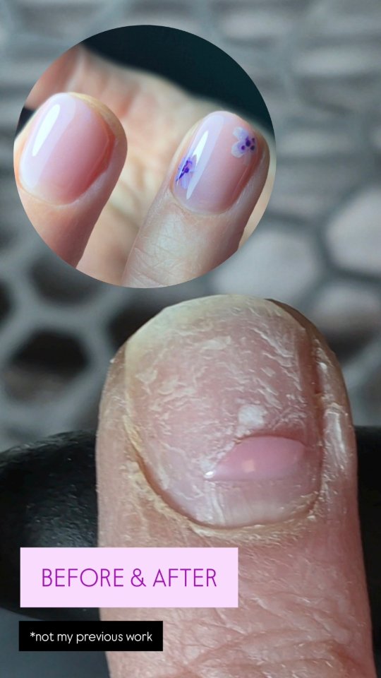 Nail transformation using @kohana_professional products, including
EB #natural
130 #belle
Acrylic paint
#nails #nailtransformation #flowernailart