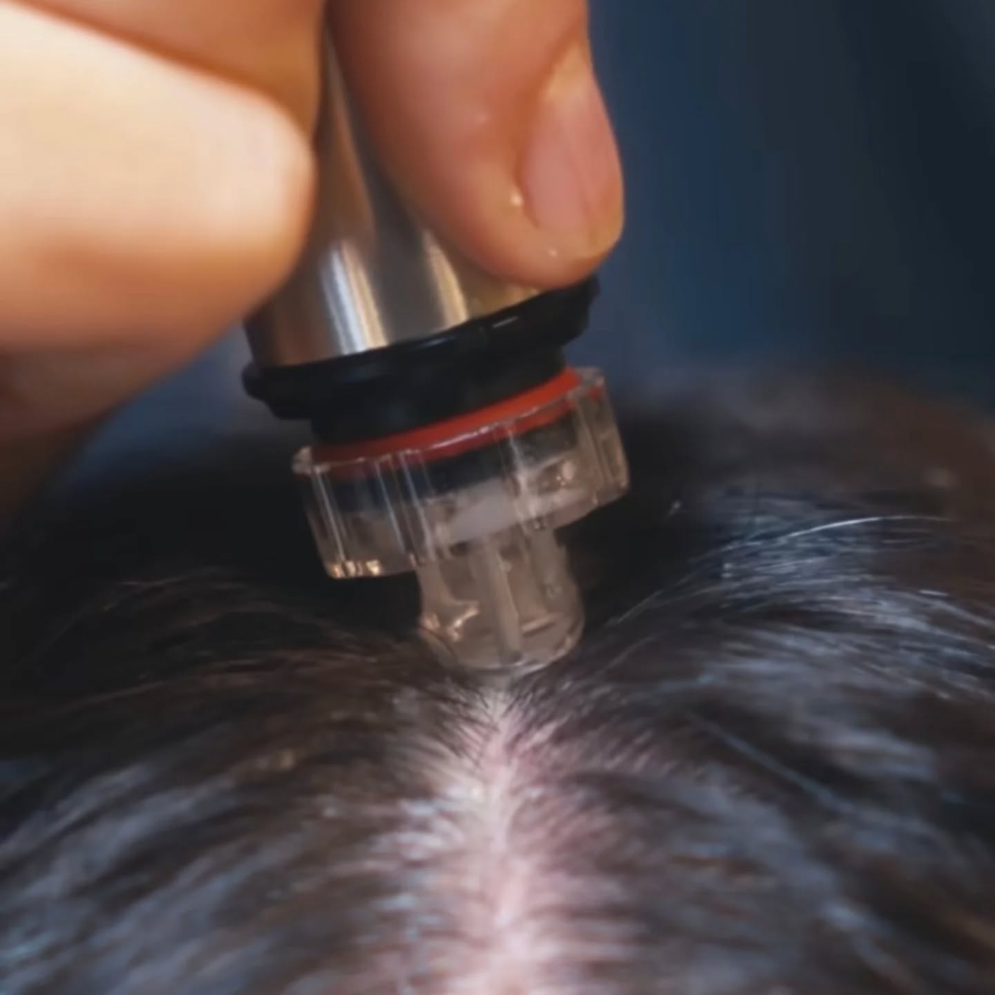 ASPIRARE TAPPI SEBACEI E FORFORA È POSSIBILE?
Con il Deep Slalp Cleanskin Aqua Peel, presto sarà possibile!
È un "reset" tecnologico per la tua cute. 🔬✨
In foto vedi il manipolo Aqua Peel, uno dei cuori pulsanti di Revita Hair Spa.
Non pulisce e basta: aspira letteralmente tappi sebacei, forfora e cellule morte che soffocano i tuoi capelli. La prova? Potrai vedere tu stesso tutte le impurità raccolte nel contenitore trasparente dopo il trattamento. 🧪🧴
Mentre installiamo queste tecnologie, i lavori per la nuova apertura procedono spediti. Stiamo creando un ambiente One to One dove la tua privacy è la priorità assoluta. 🏗️
In più di Tricovita, qui a Revita uniremo l'alta tecnologia dei macchinari alle soluzioni di infoltimento non chirurgico con le Microlinee Hairdreams
Che tu sia uomo o donna, se combatti contro il diradamento, abbiamo la soluzione definitiva che stavi cercando. 💆♂️💆♀️
Manca solo un mese...
Sei pronto a vedere i tuoi capelli rinascere? ⏳
Scrivici "INFO" nei commenti per ricevere un anteprima dei nostri protocolli esclusivi.
#RevitaHairSpa #PuliziaCute #AddioDiradamento #TecnologiaCapelli HairSpa #infoltimentocapelli Microlinea UomoDonna Privacy SaluteCapelli Tricovita NewOpening