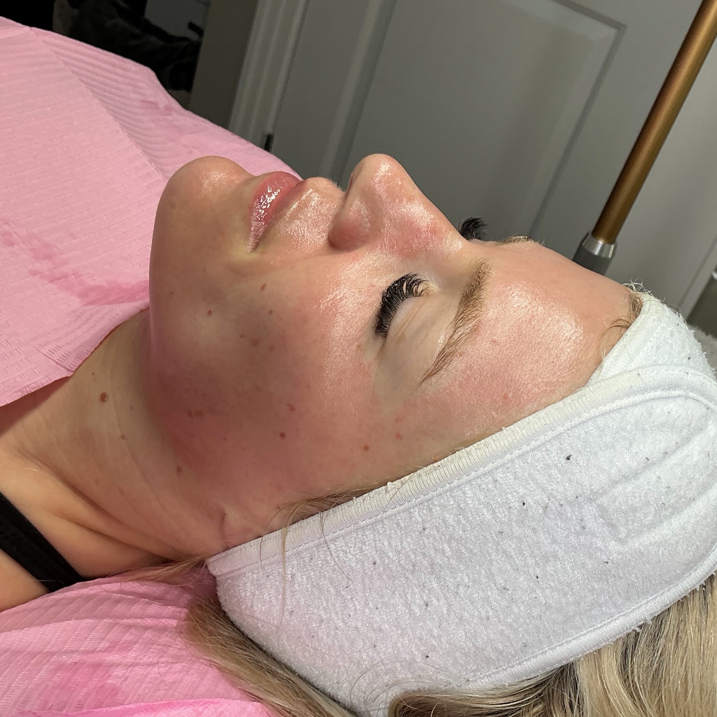 Microneedling x Dermaplaning GLOW ✨
This beautiful client came in for her first ever skin treatment and doesn’t it just look insane 🙌🏽 collagen induction from her microneedling & exfoliation/vellus hair removal from her dermaplaning - not to mention some red light therapy, a deep cleanse & mask 💕