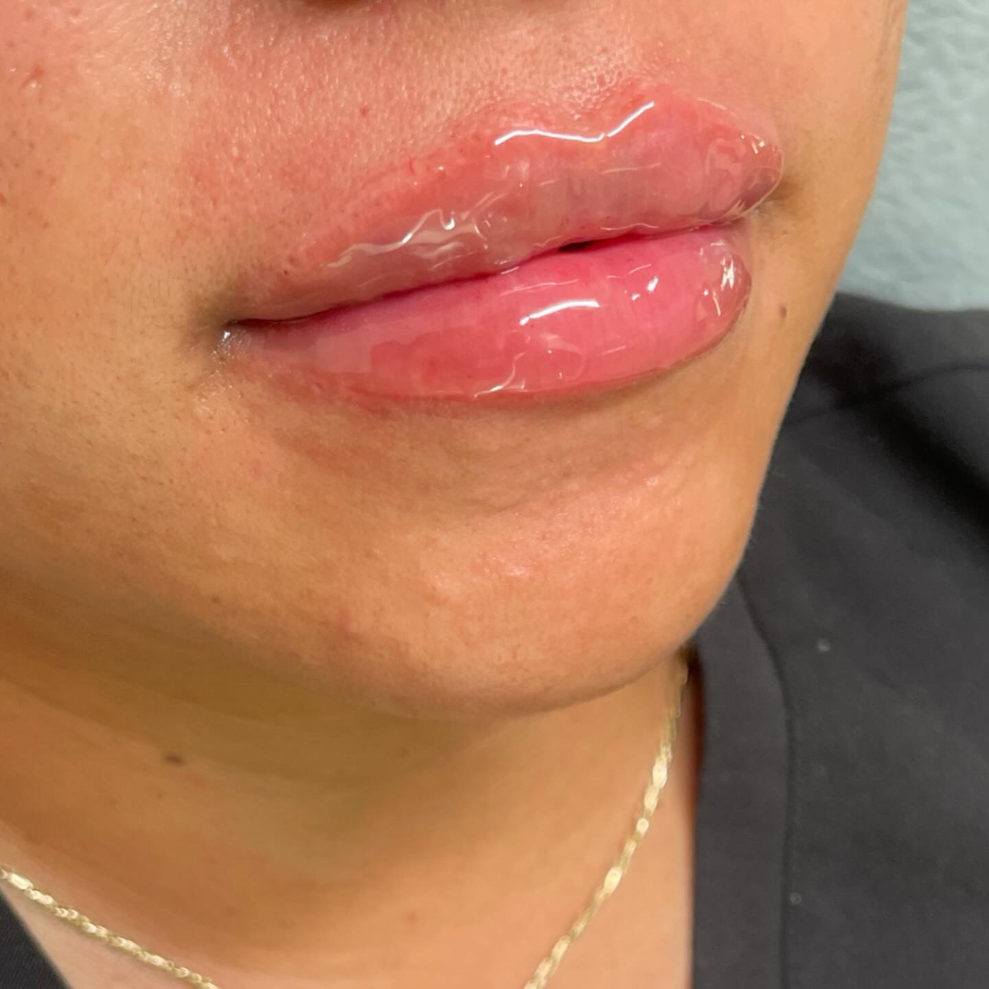 The perfect pout 💋 Booking link in bio. Dm if you have any questions ‼️🫶🏽