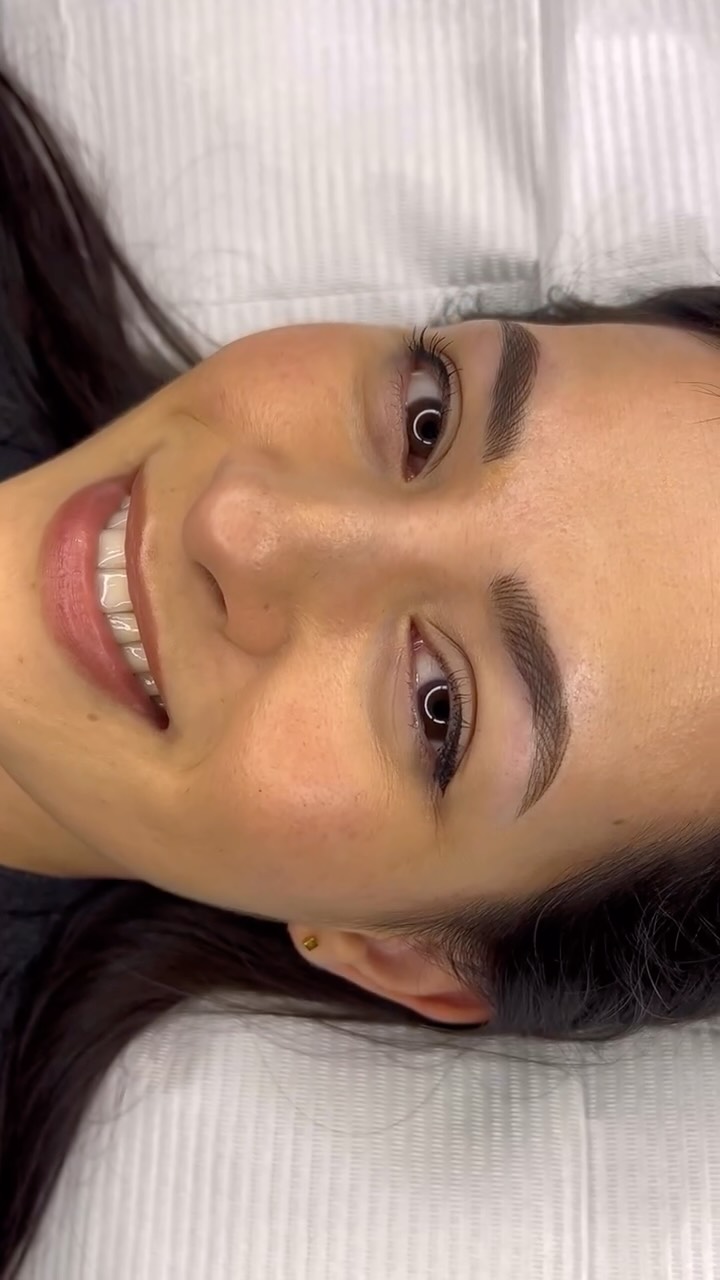 Nano Brows - Hyperrealistic Brows( Machine Hairstroke)
Nano brows are created using a machine with a single-needle technique. This method is suitable for all skin types—from normal , combination, oily skin and even mature skin.
Want REAL hair-like strokes? Nano brows create ultra-fine lines that actually heal like natural brow hair ✨
🔖 PriceList - saved in highlight
Book your appointment now! 💕
📲 Link in bio
📩 DM or WhatsApp: +44 7399288821
#phibrowslondon #ealingmicroblading #nanobrows #hyperrealisticbrows #laserremoval