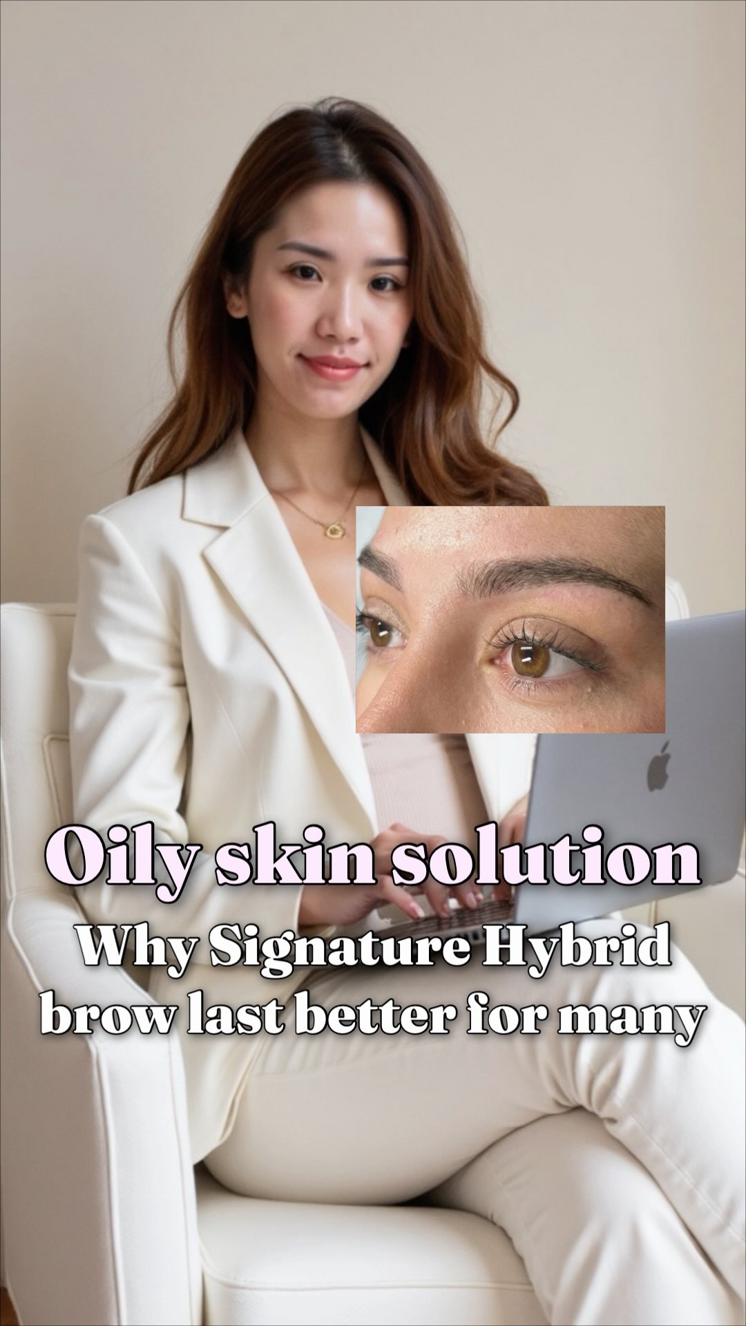 Oily skin solution? Yes—your brow tattoo just needs the right strategy 💦🤎
A lot of oily-skin clients think:
“Will it fade too fast?”
“Will the strokes blur?”
“Will my brows disappear again?” 😩
That’s exactly why Signature 3D Hybrid Brow works so well for many oily-skin clients.
Why?
Because oily skin can soften super crisp strokes faster.
By combining soft hair-like detail + shading, the healed result often looks:
✨ more even
✨ more visible
✨ longer-lasting
✨ still natural
So no—your skin isn’t the problem.
It just means your brow tattoo needs to be designed for how your skin heals, not copied from someone else’s.
The dream for oily skin:
🤎 soft, natural brows
💧 better retention
📸 no more disappearing tails
DM “BROW” + your skin type (oily/dry/normal) + your goal (soft/defined) and I’ll tell you if Signature 3D Hybrid Brow is the best option for you + send booking info. 📩
📍Luna Beauty Studio — Richmond Hill (The Clinica)
#richmondhillbrows #richmondhillpmu #richmondhillbeauty #browtattoo #pmubrows