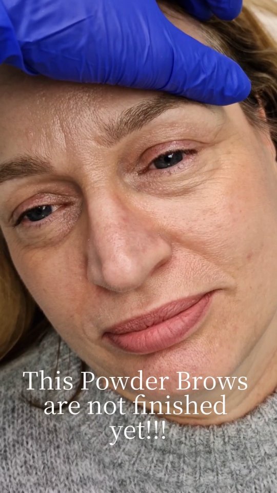This is my base, healed Powder brows after one session..now on the second session I fill in any gaps and build the colour little bit more ❤️
#ehpermanentmakeup #powderbrowsstalbans#naturalbrows #brows #herts