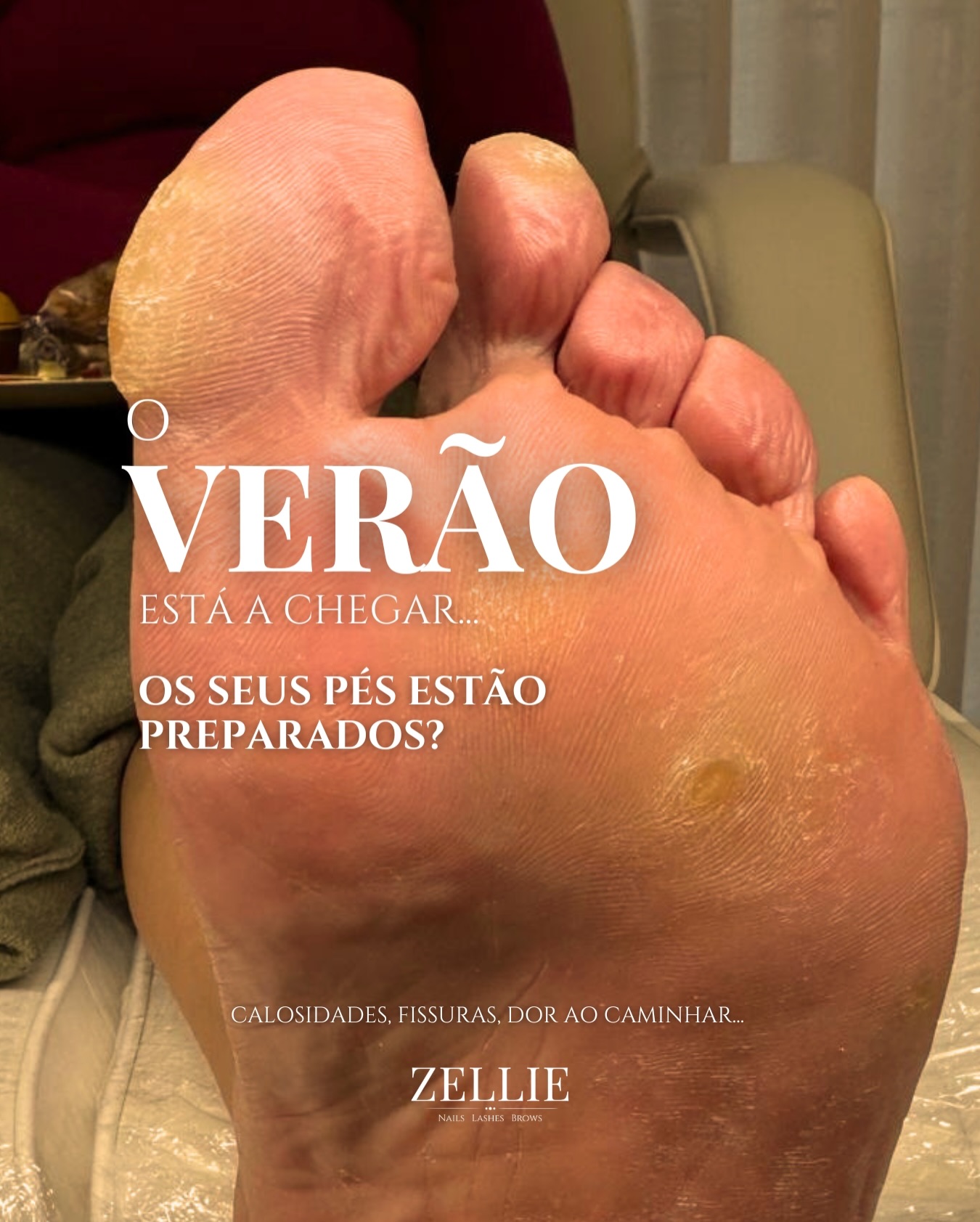 O verão aproxima-se… e os seus pés? ☀️
Calosidades, pele seca e dor ao caminhar são mais comuns do que imagina, mas não devem fazer parte da sua rotina.
Com o tratamento adequado, devolvemos saúde, conforto e confiança para que possa usar sandálias sem receio.
Porque pés bem cuidados não são apenas estética.
São qualidade de vida. 👣✨
#guimaraes #podologiaguimarães #pedicurecalista #guimaraesportugal #guimaraeslifestyle