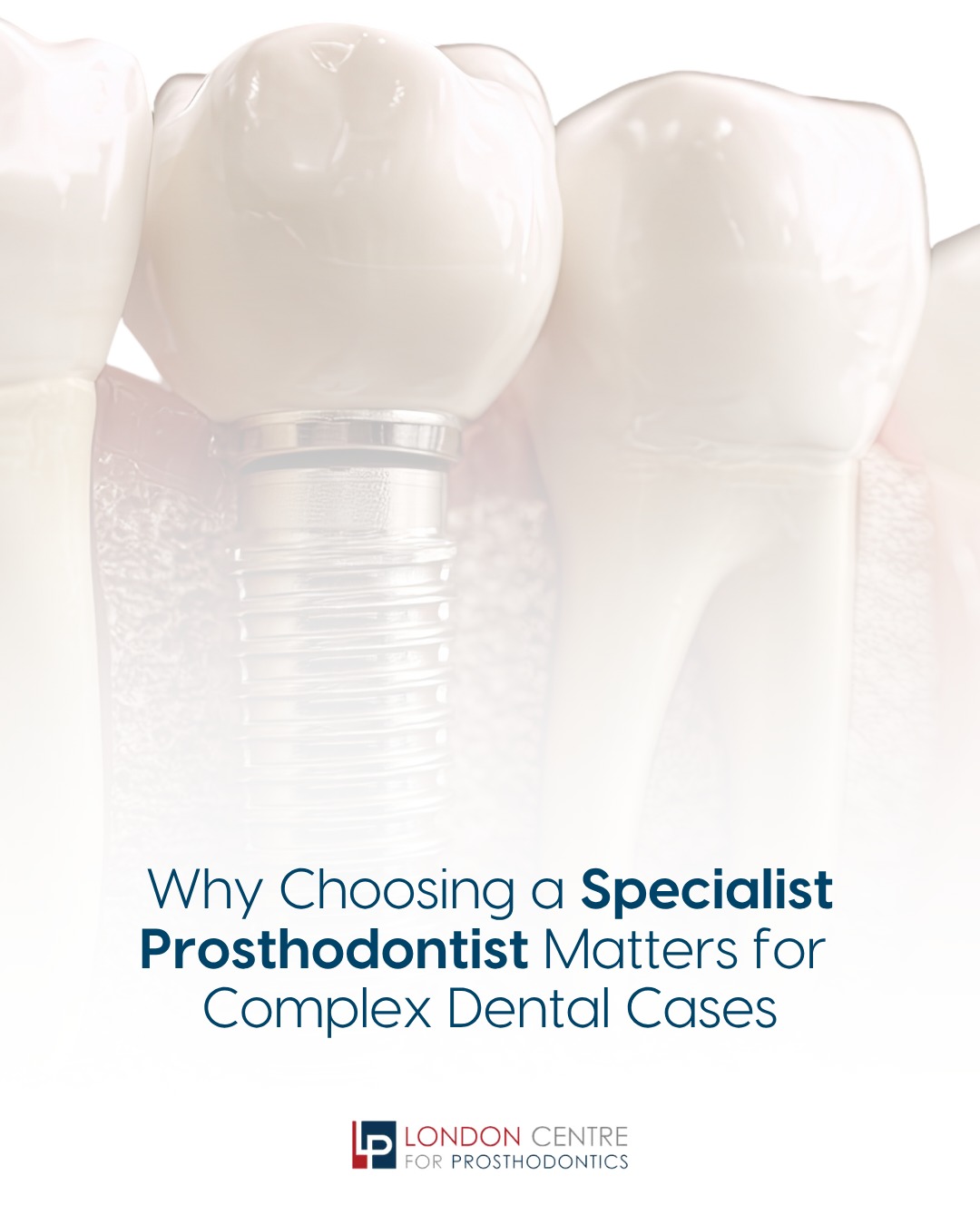 Choosing a Specialist Prosthodontist means your care is guided by advanced training, precision and experience.
For complex dental cases, this expertise ensures safer treatment, predictable outcomes and long‑lasting results.
Get in touch with our team to book your appointment - we look forward to seeing you soon!
The London Centre For Prosthodontics
29 Weymouth Street
London, W1G 7DB
020 7637 4518
info@londonprosthodontics.com
Monday - Friday: 7:30am - 4:30pm
#SmileMakeover #EmergencyDentistLondon #LondonDentalClinic #SmileTransformation #CosmeticDentistLondon