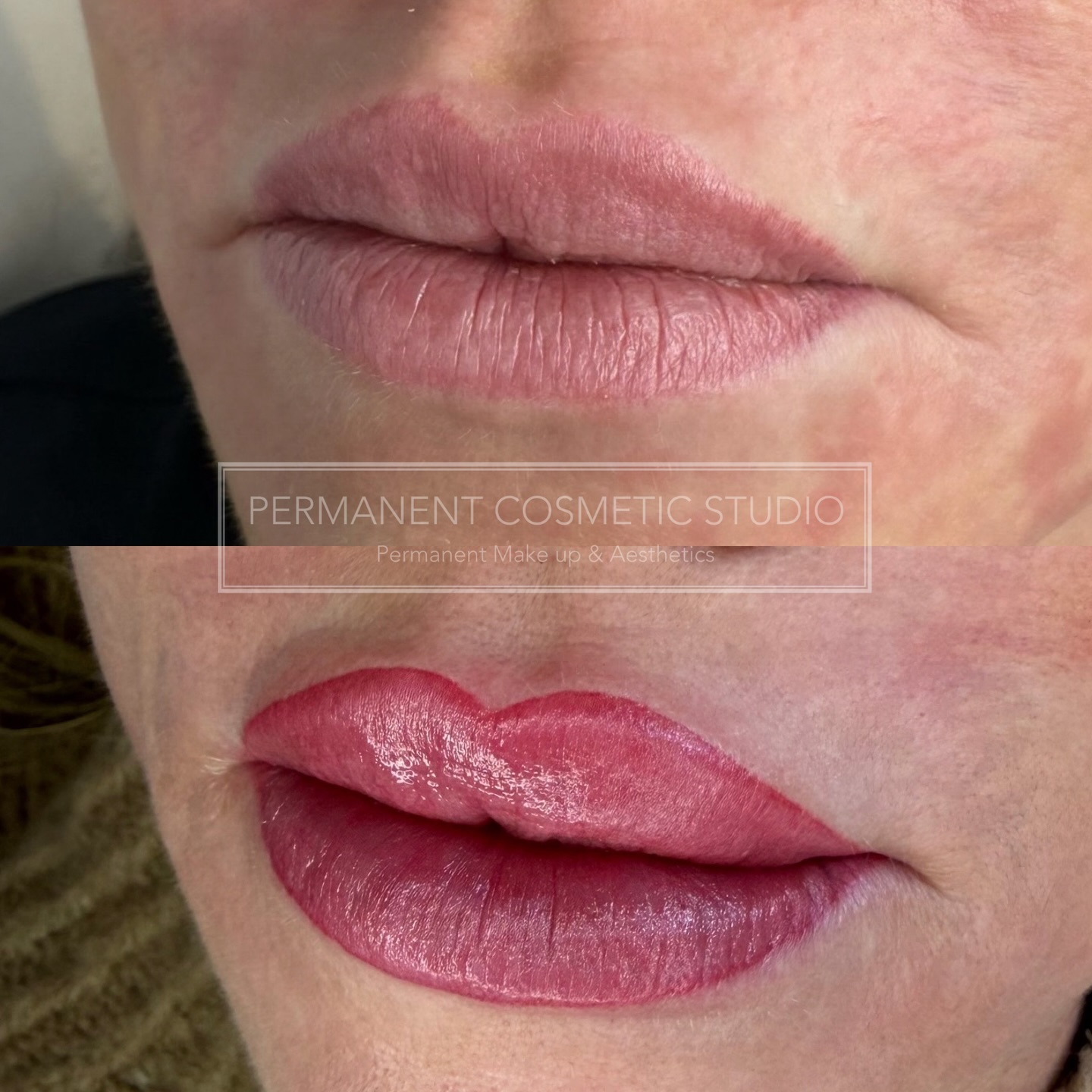 Lip blush correction from another artist for improved shape and symmetry with this beautiful shade… 😍😍
.
.
.
.
.
#lipblushlondon
#lipblushuk
#lipblushresults
#lipblushhealed
#naturallipcolour