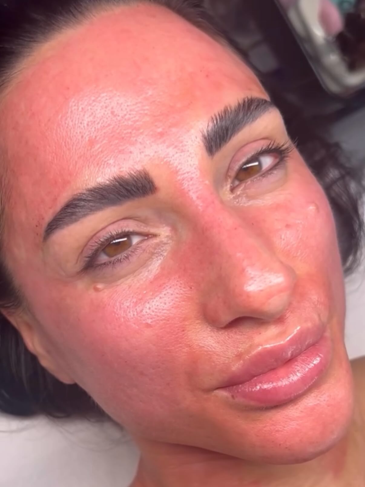 Yes a lil red, but that’s the magic happening.
My Salon days are filled with both micro needling but also skin peels at the moment and I LOVE it!beauty The results are always worth a little redness✨🫶🏽 #microneedlingtreatment #newskin #zürich #happiness #collagen