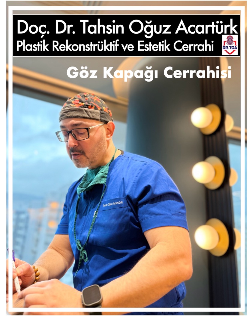 Blefaroplasti (göz kapağı estetiği)
Amaç: Üst göz kapağındaki sarkmış deri ve yağ dokularının alınarak daha genç, dinç ve aydınlık bir bakış ifadesi kazandırılmasını sağlar. Ayrıca görüş alanını kısıtlayan ağırlaşmış kapakların düzeltilmesine yardımcı olur.
İşlem: Genellikle lokal anestezi altında yapılır. Üst kapakta doğal katlanma çizgisi üzerinden kesi yapıldığı için iyileşme sonrası izler büyük oranda gizlenir ve zamanla azalır.
İyileşme Süreci: İşlemden sonra ilk birkaç gün hafif şişlik ve morluk görülmesi normaldir. Çoğu hasta yaklaşık 10 gün içinde sosyal hayatına ve işine dönebilir, dikişler genellikle 7 gün içinde alınır.
#blefaroplasti #gözkapağıestetiği #oküloplasti #plastikcerrahi #estetikcerrahi #gençleşme #bakış #gözçevresi #blepharoplasty #estetikcerrah