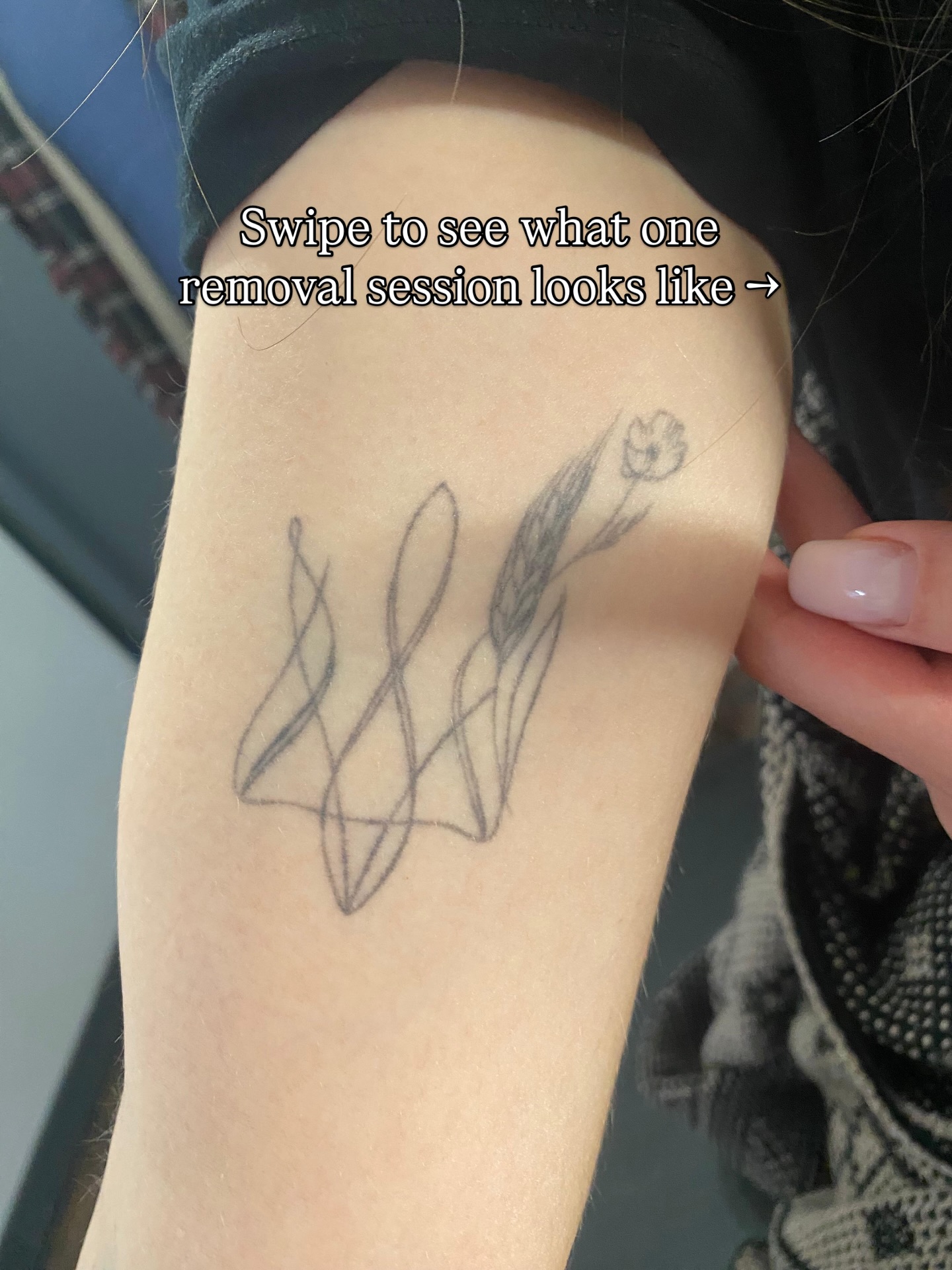 Already a lot of progress after one session…😍
Book your first session today! We offer free consultations so we can give you an accurate quote.
Call or text 07542902219 for all booking enquiries.
#tattooscotland #lasertattooremoval #removallaser #glasgowtattoo #laserremoval