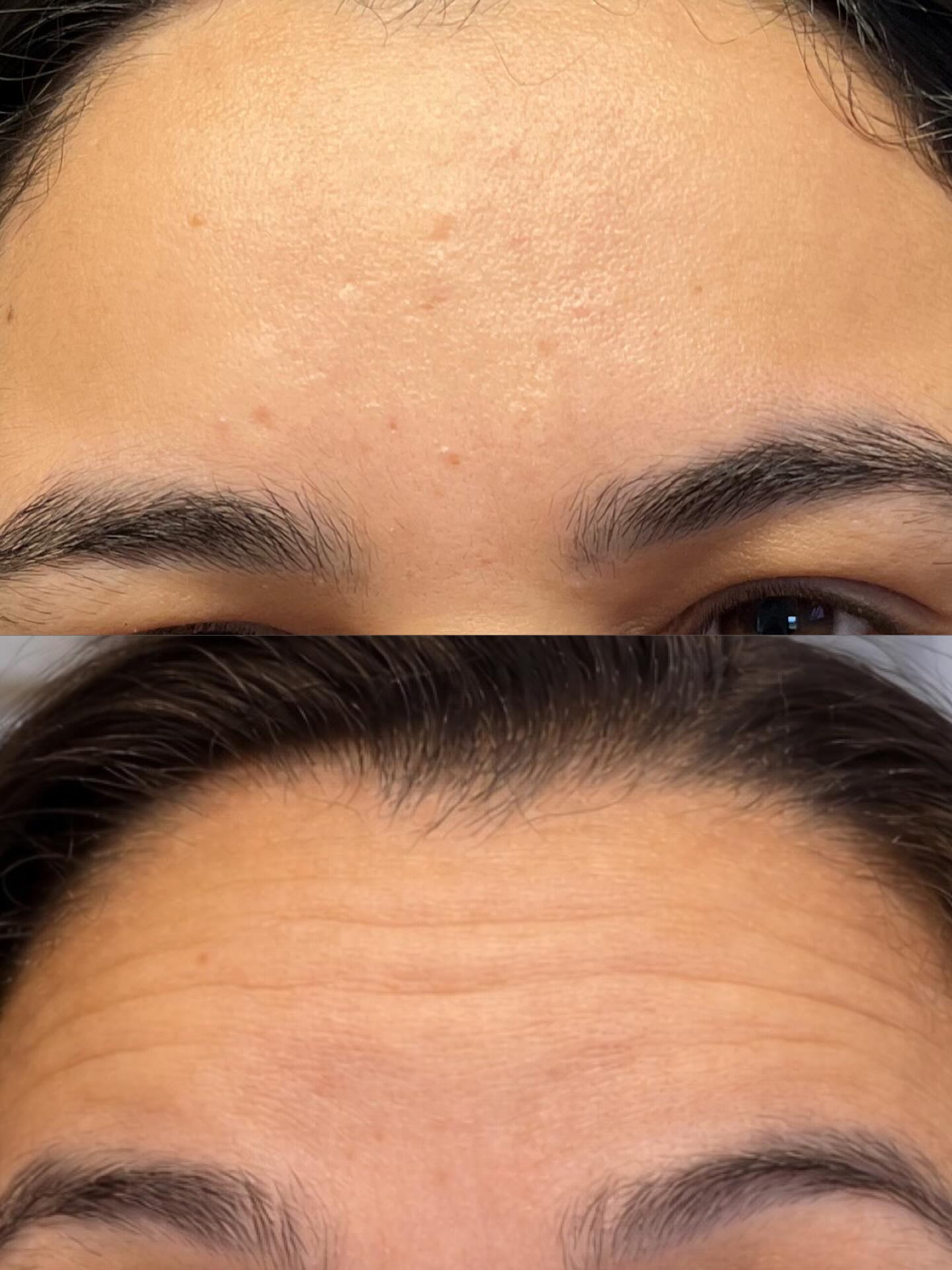 No caption needed! Bye bye wrinkles