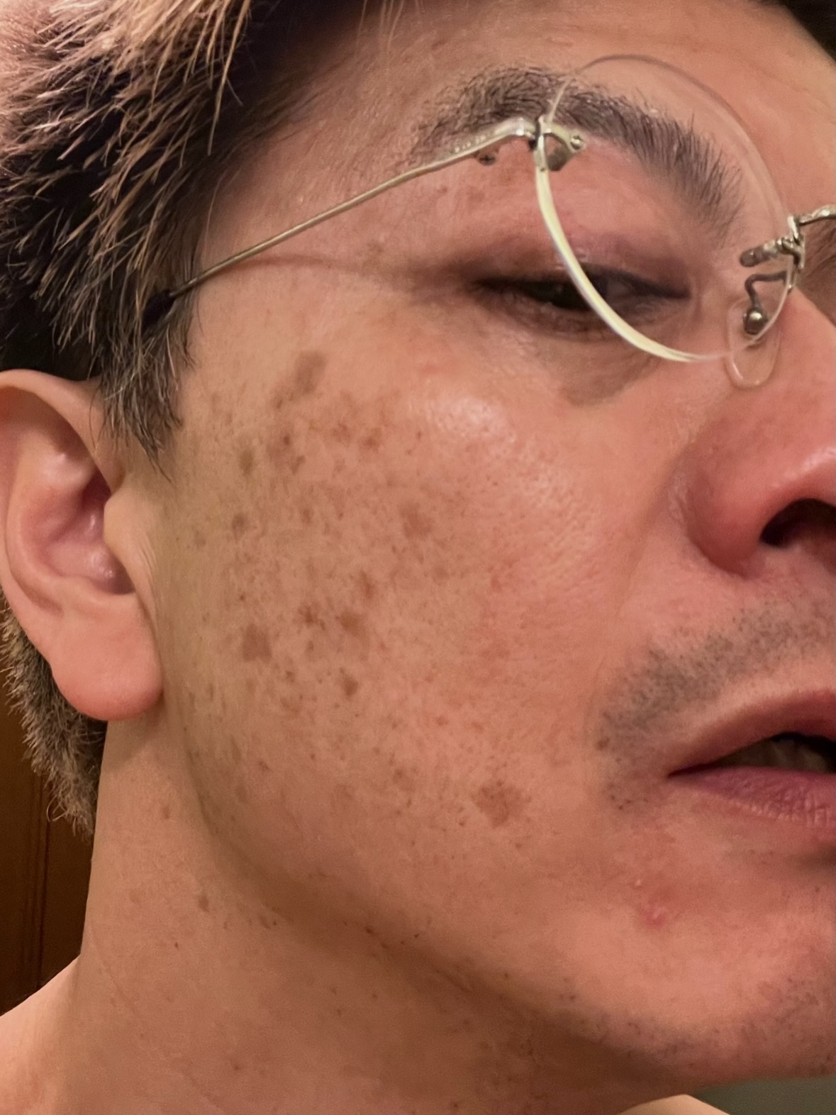 男の子もスキンケア
金髪時代(2年前)の肌と現在の肌。