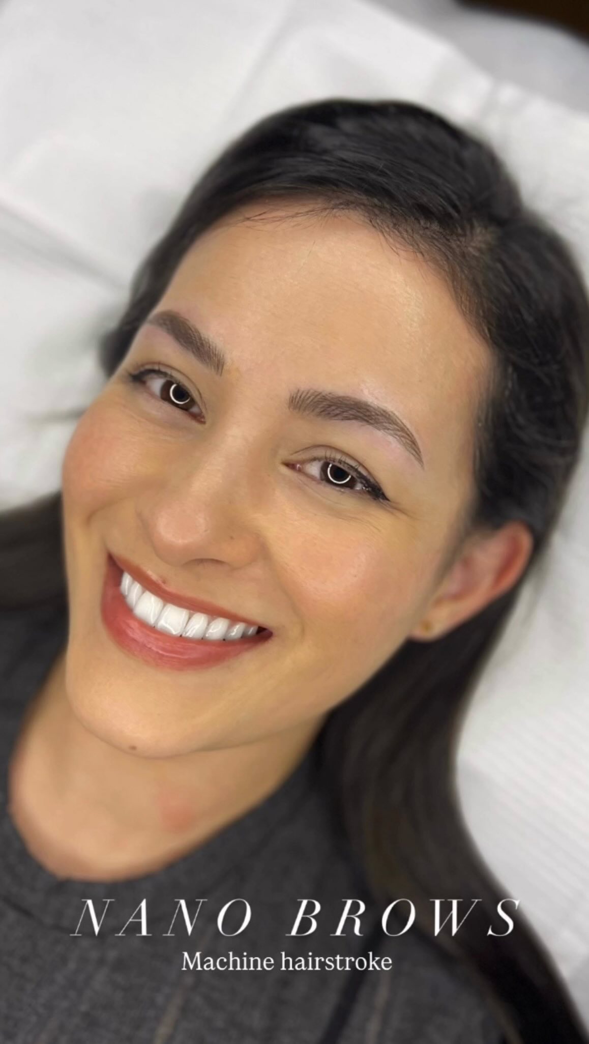 Do you have sparse brows but want full, fluffy ones?
Nano Hyperrealistic Brows is a technique where we add fine hair strokes that blend seamlessly with your natural brows, creating a fuller, soft, and natural look.
Nano brows are created using a machine with a single-needle technique. This method is suitable for all skin types—from normal , combination, oily skin and even mature skin.
Interested in transforming your brows?
Send us a DM !
-
PhiBrows artist - SPMU specialist based in Ealing Broadway, West London.
🔖 PriceList - saved in highlight
Book your appointment now! 💕
📲 Link in bio
📩 DM or WhatsApp: +44 7399288821
#phibrowslondon #ealingmicroblading #nanobrows #hyperrealisticbrows #laserremoval