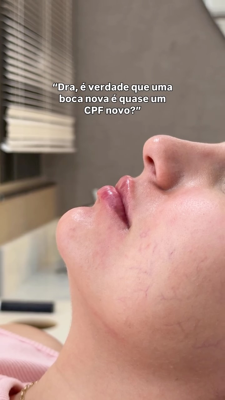 Confirmem os boatos💋✨💉
Um lábio preenchido NA MEDIDA CERTA pode ser exatamente o que você precisa agora!
Acesse o perfil e conheça mais sobre o meu trabalho 🥰 você vai amar tanto que vai querer ficar!
.
#estetica #labios #mulher #maraba