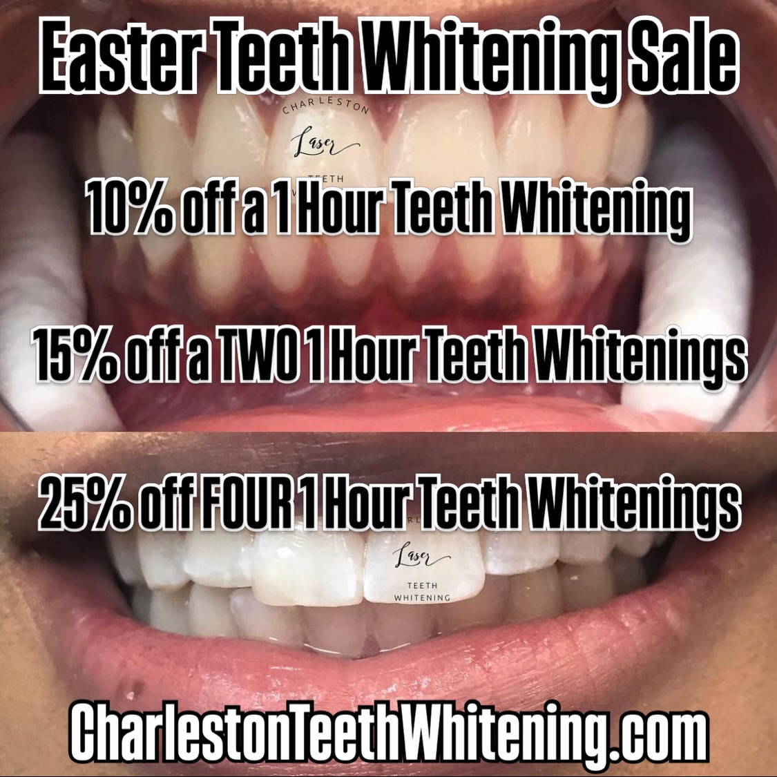 🥚🐇Easter Teeth Whitening Sale 🐇🥚
10% off a 1 Hour Teeth Whitening
15% off a TWO 1 Hour Teeth Whitenings
25% off FOUR 1 Hour Teeth Whitenings
Buy Now!
www.CharlestonTeethWhitening.com
Book Later!
www.CharlestonLaserTeethWhitening.com
#teethwhitening #charlestonteethwhitening #charleston #charlestonsc #charlestonlaserteethwhitening mountpleasant mountpleasantsc kiawahisland kiawahjamesisland westashley isleofpalms downtowncharleston sullivansisland johnsisland johnsisland northcharleston northcharlestonsc folly follybeach laserteethwhitening Easter eastersale charlestonteethwhiteningsale