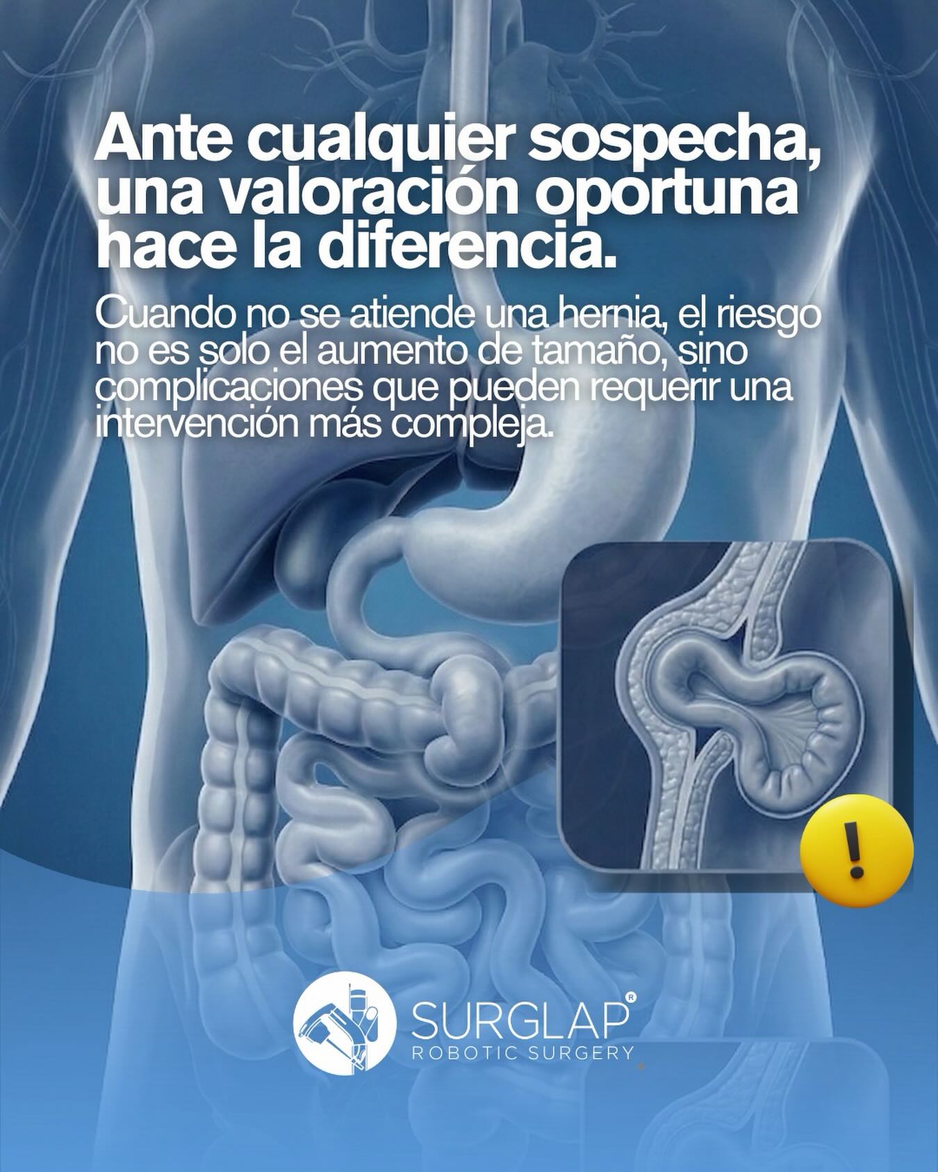 La hernia inguinal aparece cuando una parte del tejido abdominal protruye a través de un punto débil en la pared muscular.
Al inicio puede parecer algo menor: una molestia, una ligera inflamación o una sensación de peso.
Pero con el tiempo, tiende a progresar.
No existen medicamentos ni ejercicios que la corrijan.
El tratamiento definitivo es quirúrgico.
Cuando no se atiende, el riesgo no es solo el aumento de tamaño, sino complicaciones que pueden requerir una intervención más compleja.
Por eso, el enfoque correcto no es adaptarse a la molestia,
es resolver el problema de forma adecuada.
Ante cualquier sospecha, una valoración oportuna hace la diferencia.
#HerniaInguinal #CirugíaGeneral #SaludQuirúrgica #Prevención #AtenciónMédica