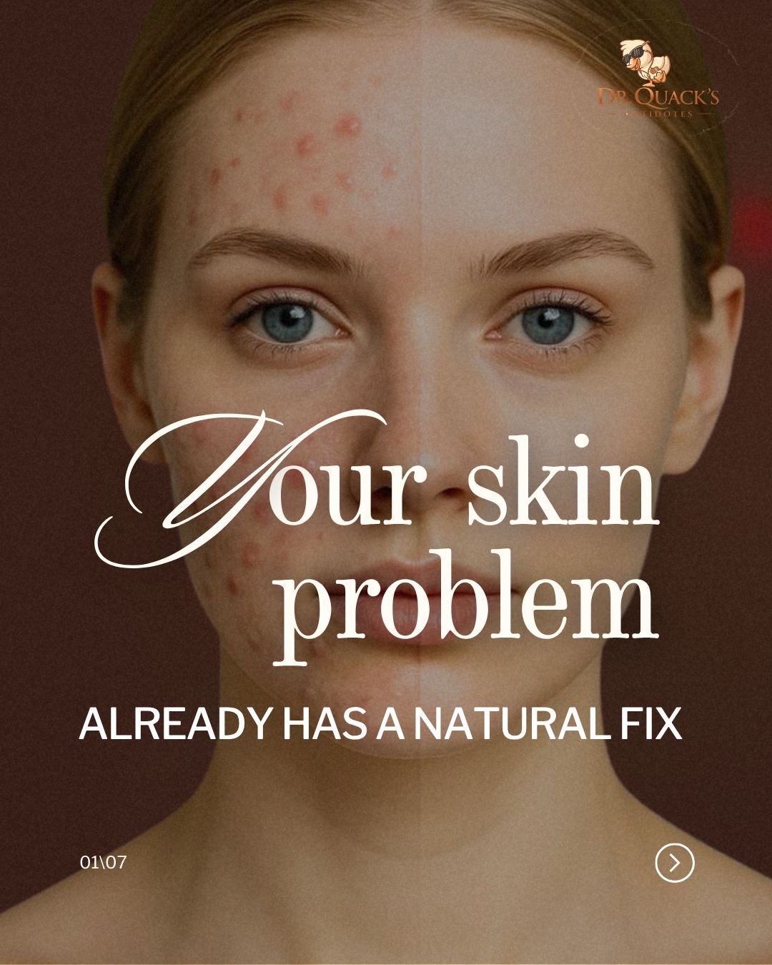 Skin isn’t the problem—it’s the signal.
Listen to it, nourish it, and heal it the way nature intended.
Seipe to learn more
Dr. Quacks Antidotes
#acne #skinfood #skinproblem #skincare #naturalingredients