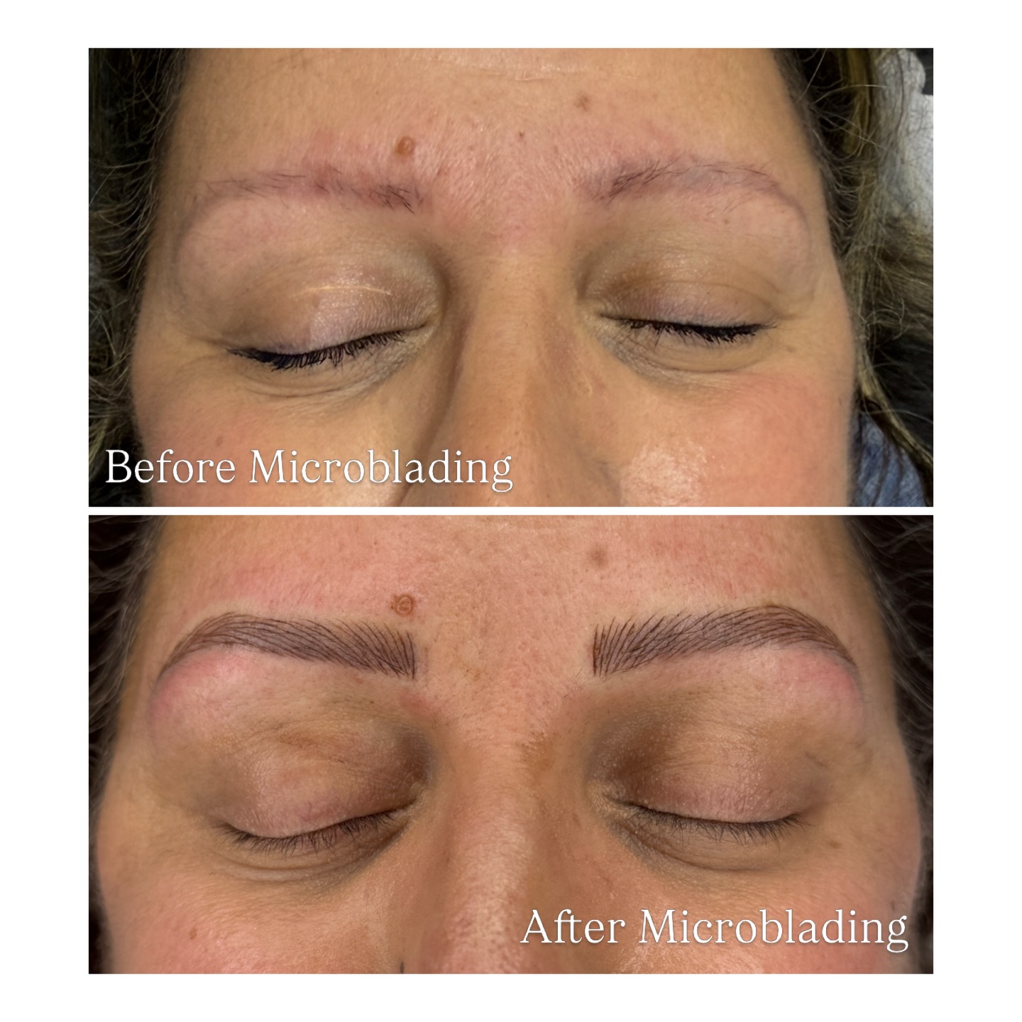 Microblading that boosts confidence and makes your makeup routine simpler✨
Natural-looking hair-like strokes that mimic real brow texture
Improved shape and symmetry for a more balanced face
Reduced daily brow time (less filling, easier routine)
Fuller appearance for sparse or uneven brows
Smudge-resistant definition compared to many daily brow products
Book your FREE consultation with our brow specialist. We’ll walk you through every detail of your pre- and post-treatment care, so you feel fully informed, confident, and comfortable every step of the way 🤍
Book online through the link in our profile or call us at 905-850-5899