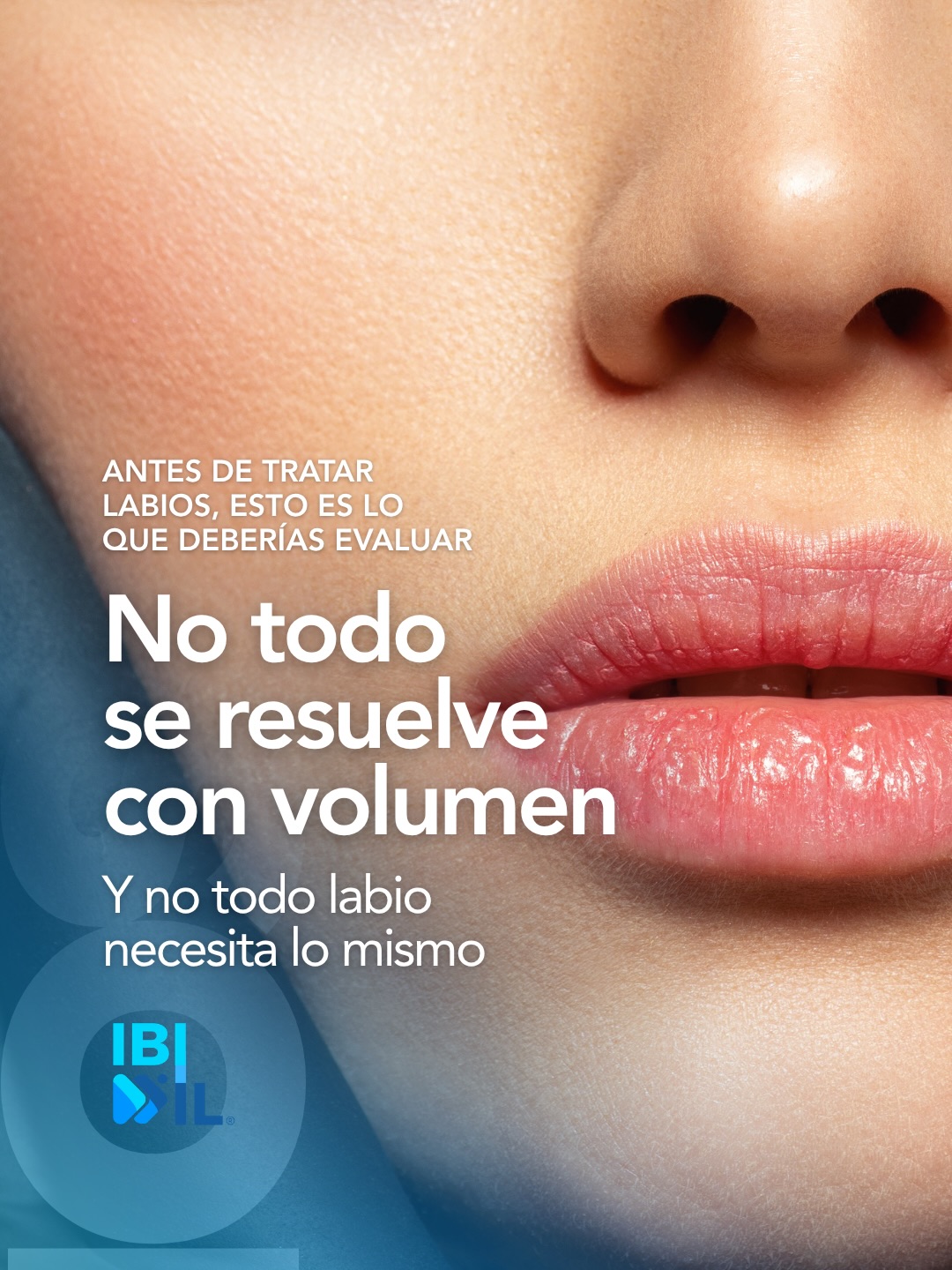 Tratar labios no debería empezar pensando en producto.
Debería empezar pensando en evaluación.
Porque no todo se resuelve con volumen.
Y no todo labio necesita lo mismo.
La proporción, el soporte, la estructura, los cambios por edad y la forma natural del paciente son parte de lo que realmente cambia una indicación.
De hecho, una buena evaluación no solo te orienta sobre qué puedes hacer, sino también sobre qué no deberías hacer.
Y esa diferencia es clave.
Porque un tratamiento bien indicado no empieza en la aguja. Empieza en el análisis clínico.
Si quieres profundizar en este tema, te invitamos a nuestra Masterclass Anatomía de labios y mejores tratamientos, dictada por el Dr. Víctor Ollarves Ruiz.
@dr.victorollarvesruiz
7 de abril
Vía Zoom
Inversión: REF 25
Comenta LABIO y te enviamos la información para inscribirte.